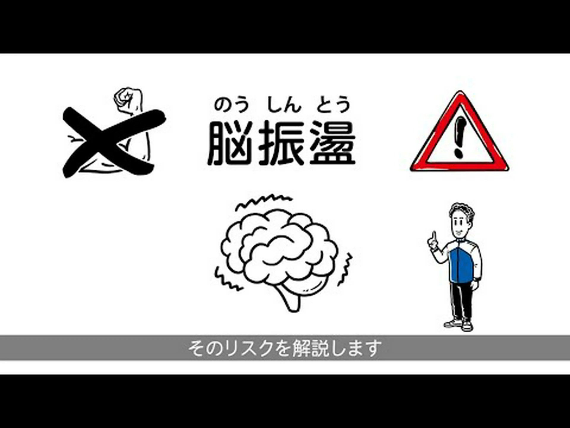 脳震盪は無害すぎるように聞こえる 脳震盪は無害すぎるように聞こえる