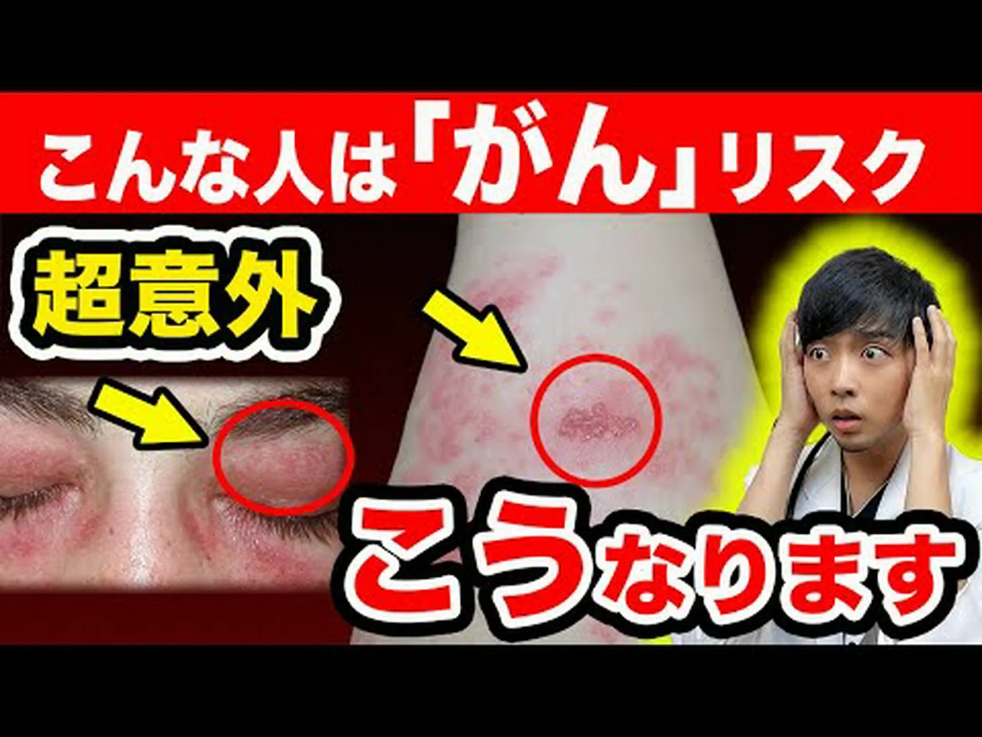 ウイルスと皮膚がんの関連性を示す新たな証拠が発見された ウイルスと皮膚がんの関連性を示す新たな証拠が発見された