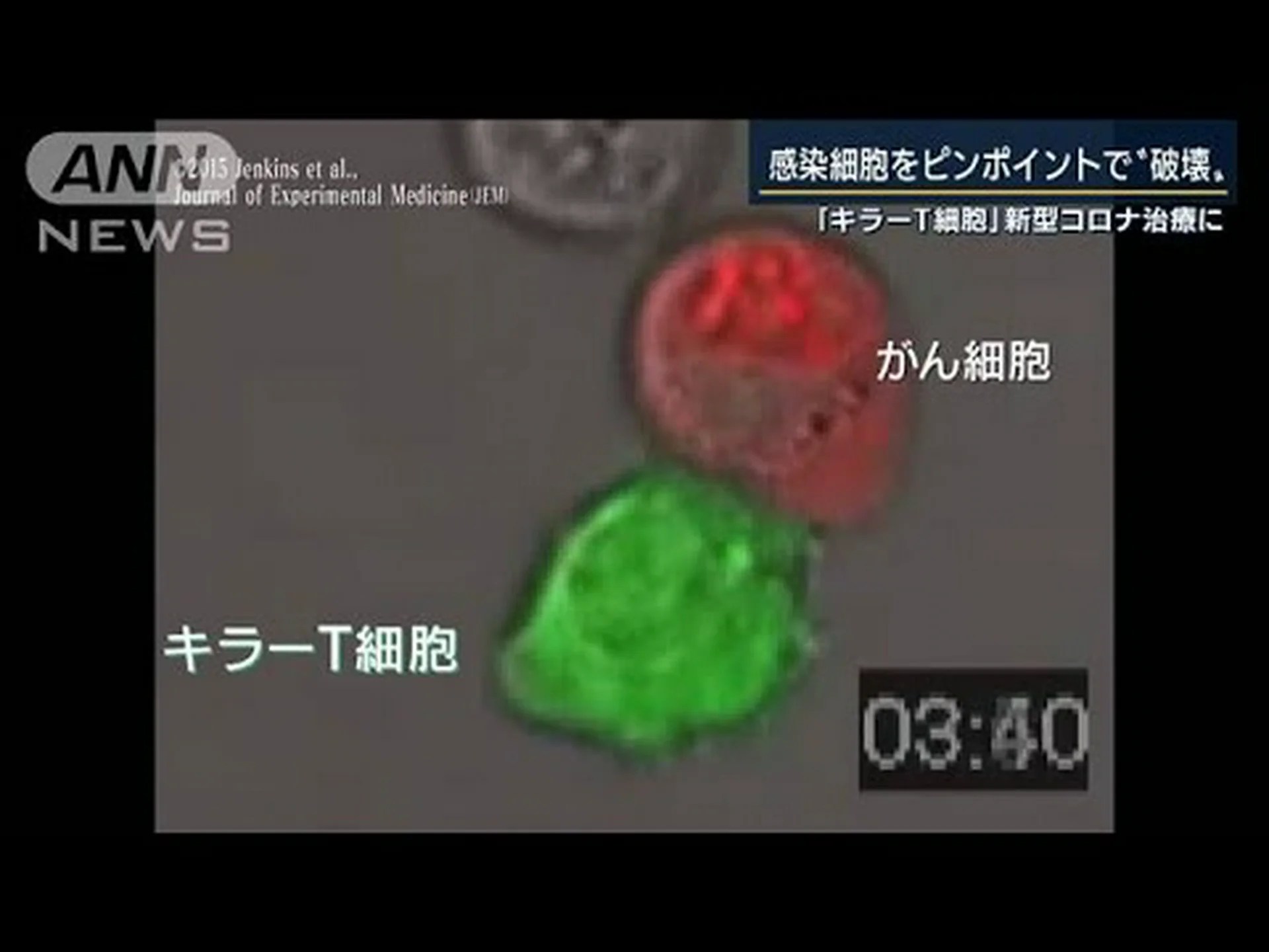 エイズに対するキラー細胞 エイズに対するキラー細胞