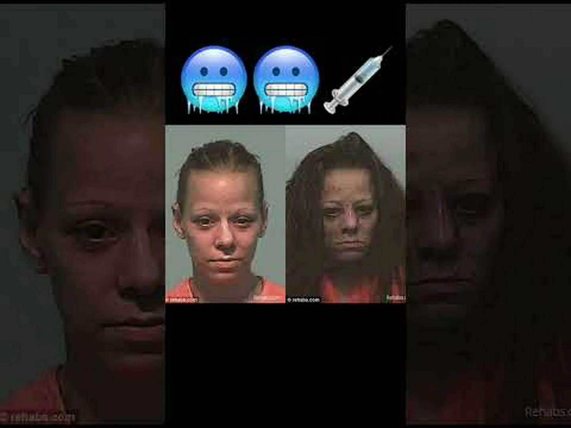 研究者たちはコカイン中毒の可能性のある鍵を発見 研究者たちはコカイン中毒の可能性のある鍵を発見