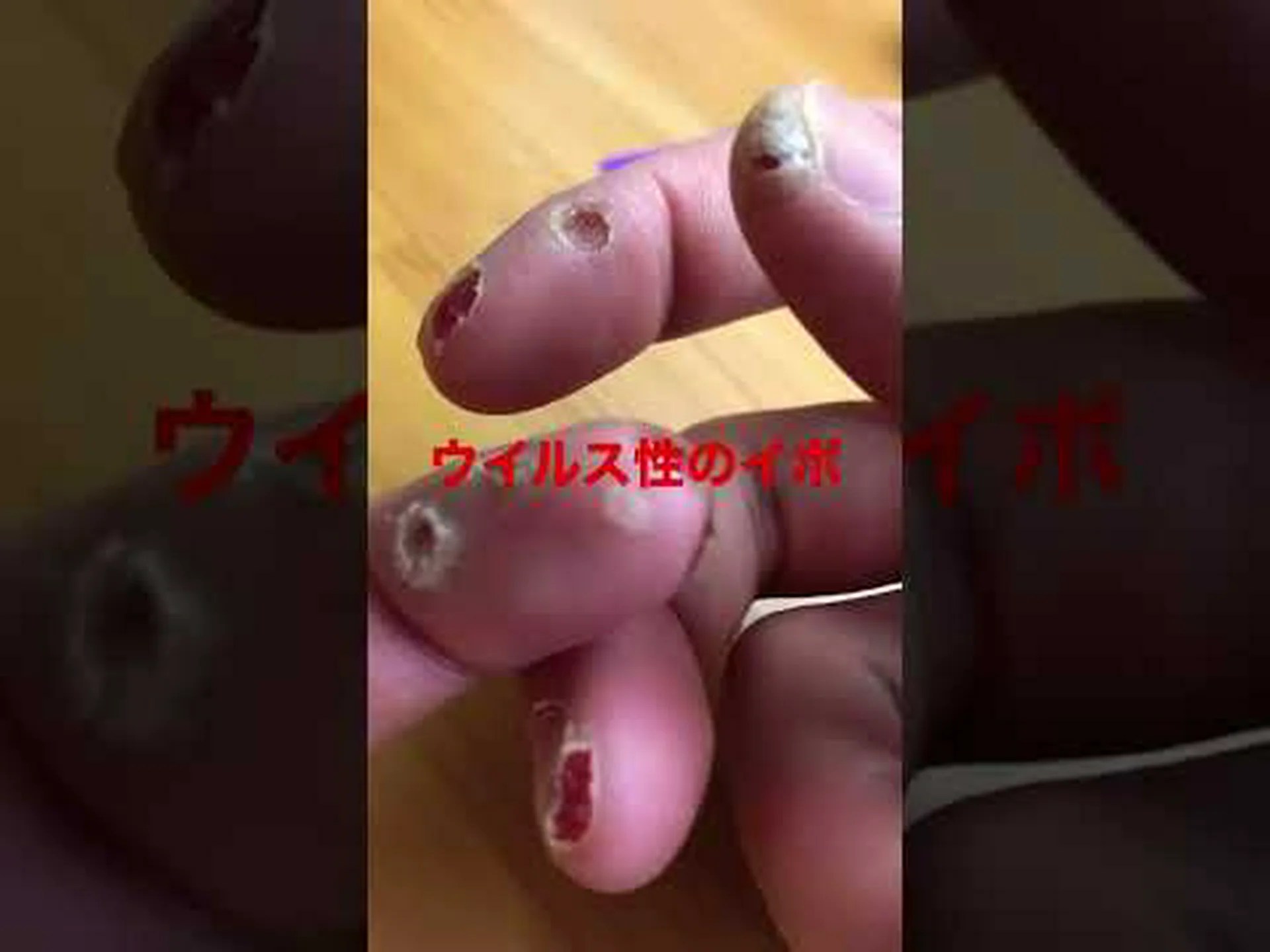 ガンの主な原因: ランダムなコピーエラー ガンの主な原因: ランダムなコピーエラー