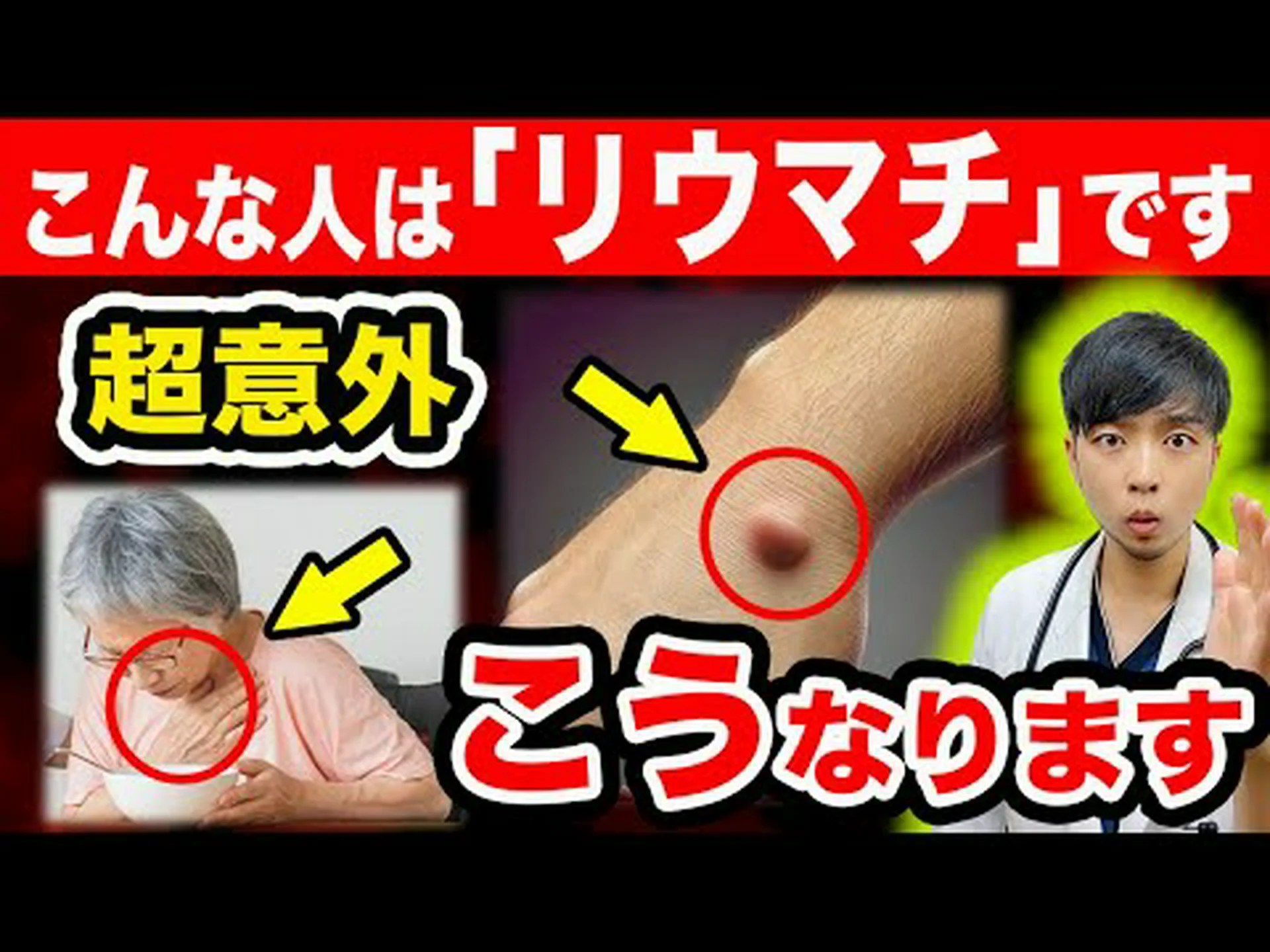 リウマチと戦うための新しい武器 リウマチと戦うための新しい武器