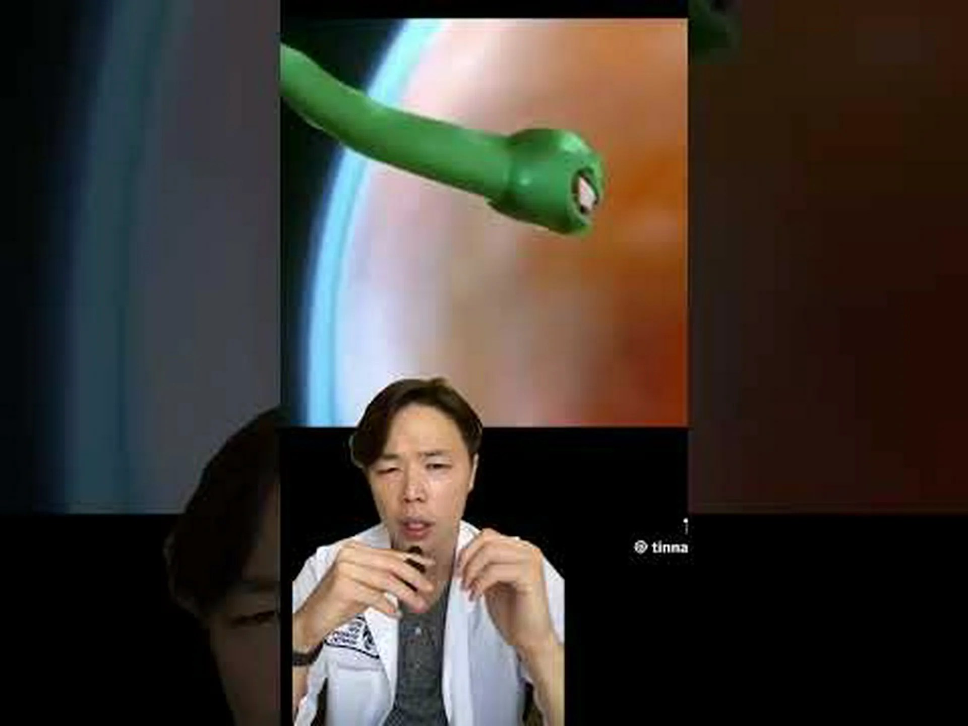 卵細胞はその温かさで精子を引き寄せる 卵細胞はその温かさで精子を引き寄せる