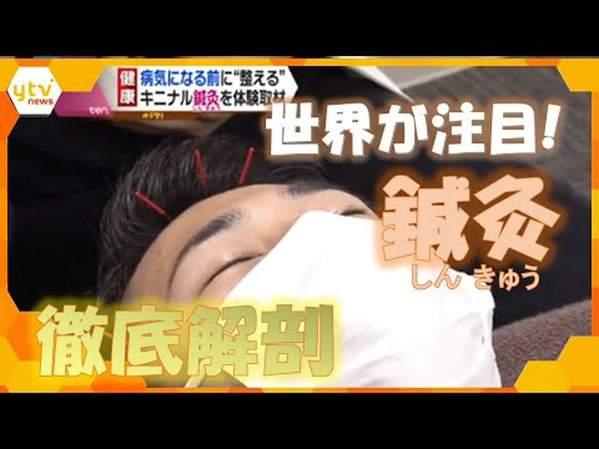 研究者が鍼治療の効果を証明 研究者が鍼治療の効果を証明