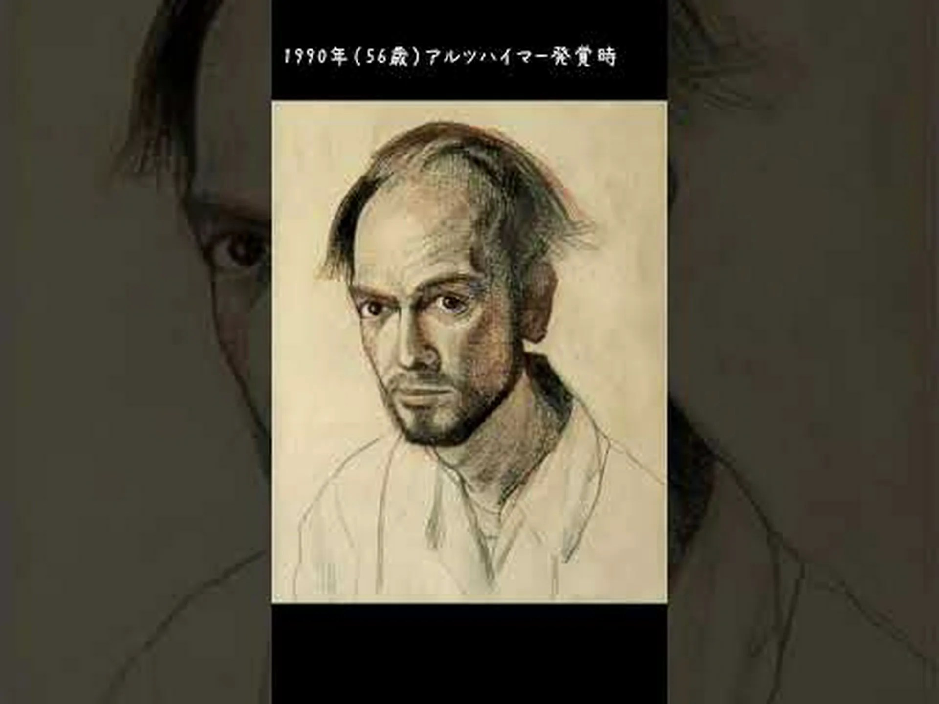 アルツハイマー病の目を見つめる アルツハイマー病の目を見つめる