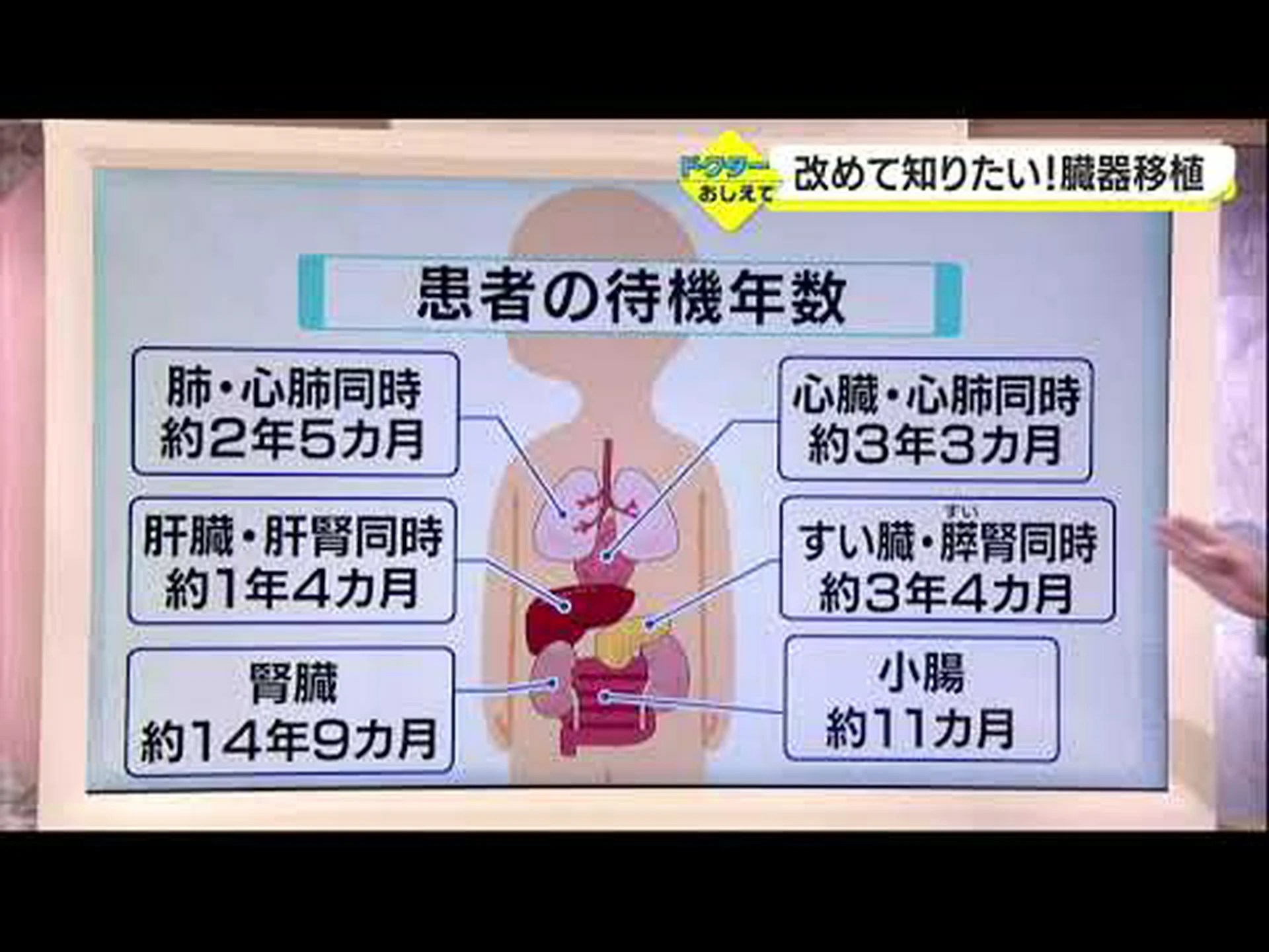 がん患者からの臓器提供は腫瘍のリスクを転嫁する がん患者からの臓器提供は腫瘍のリスクを転嫁する