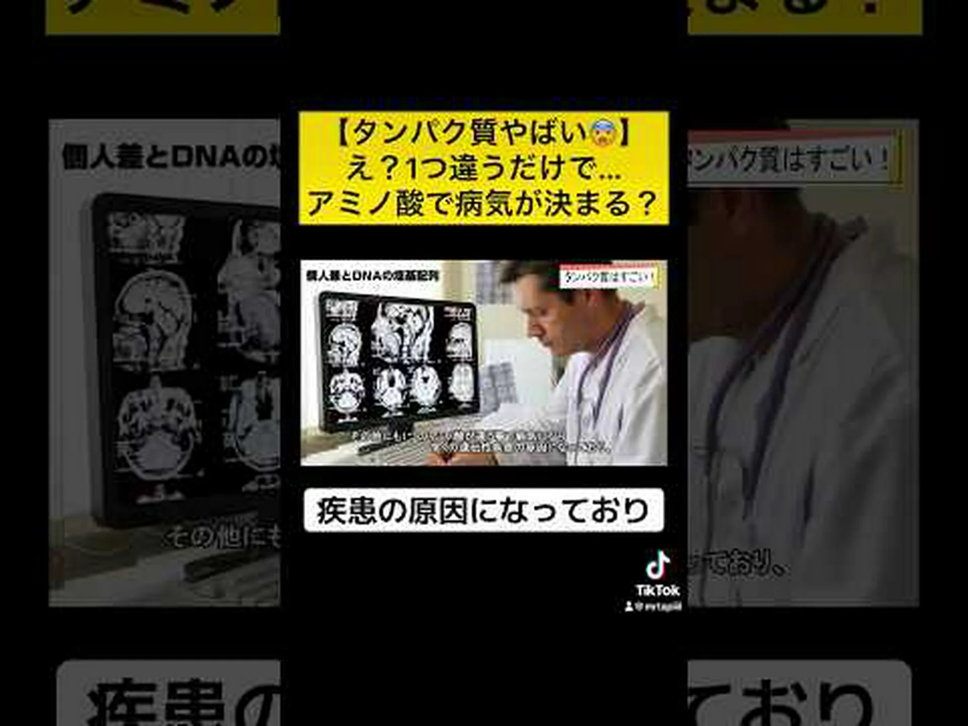 間違ったアミノ酸がどのように病気を引き起こすのか 間違ったアミノ酸がどのように病気を引き起こすのか