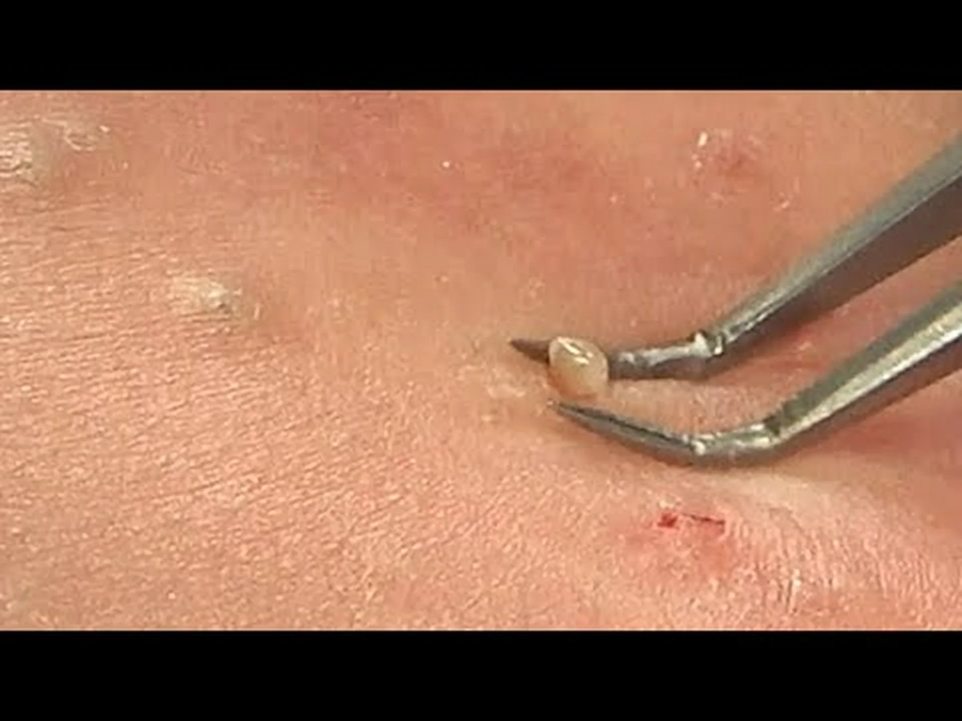 細流の跡で 細流の跡で