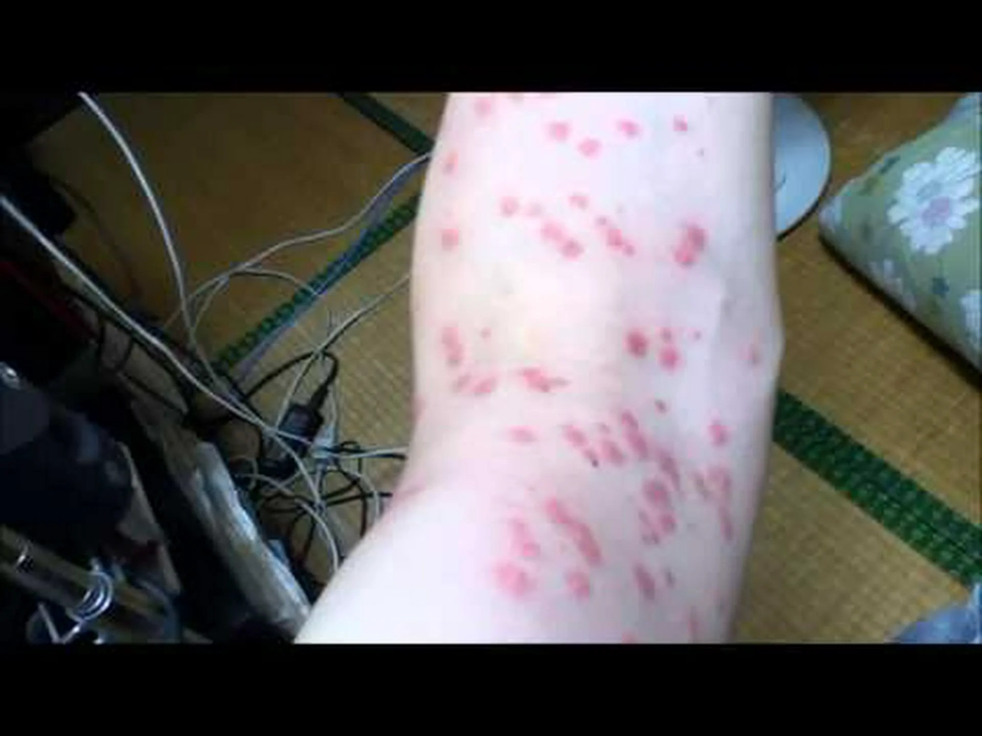 鋼鉄のような硬い噛み虫: 毛虫の顎には金属が入っています。 鋼鉄のような硬い噛み虫: 毛虫の顎には金属が入っています。