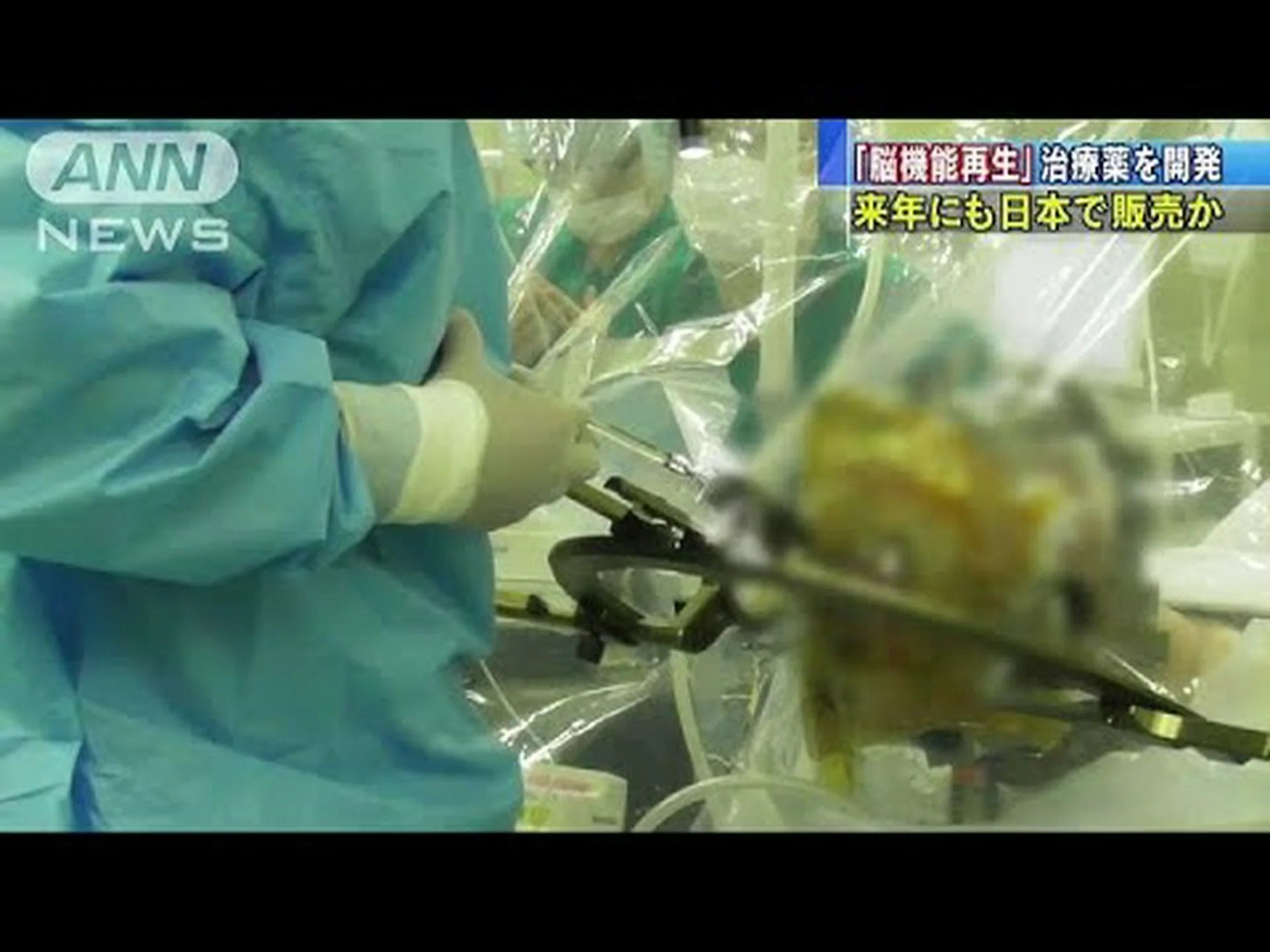 骨髄の細胞が脳卒中の損傷を治癒する 骨髄の細胞が脳卒中の損傷を治癒する