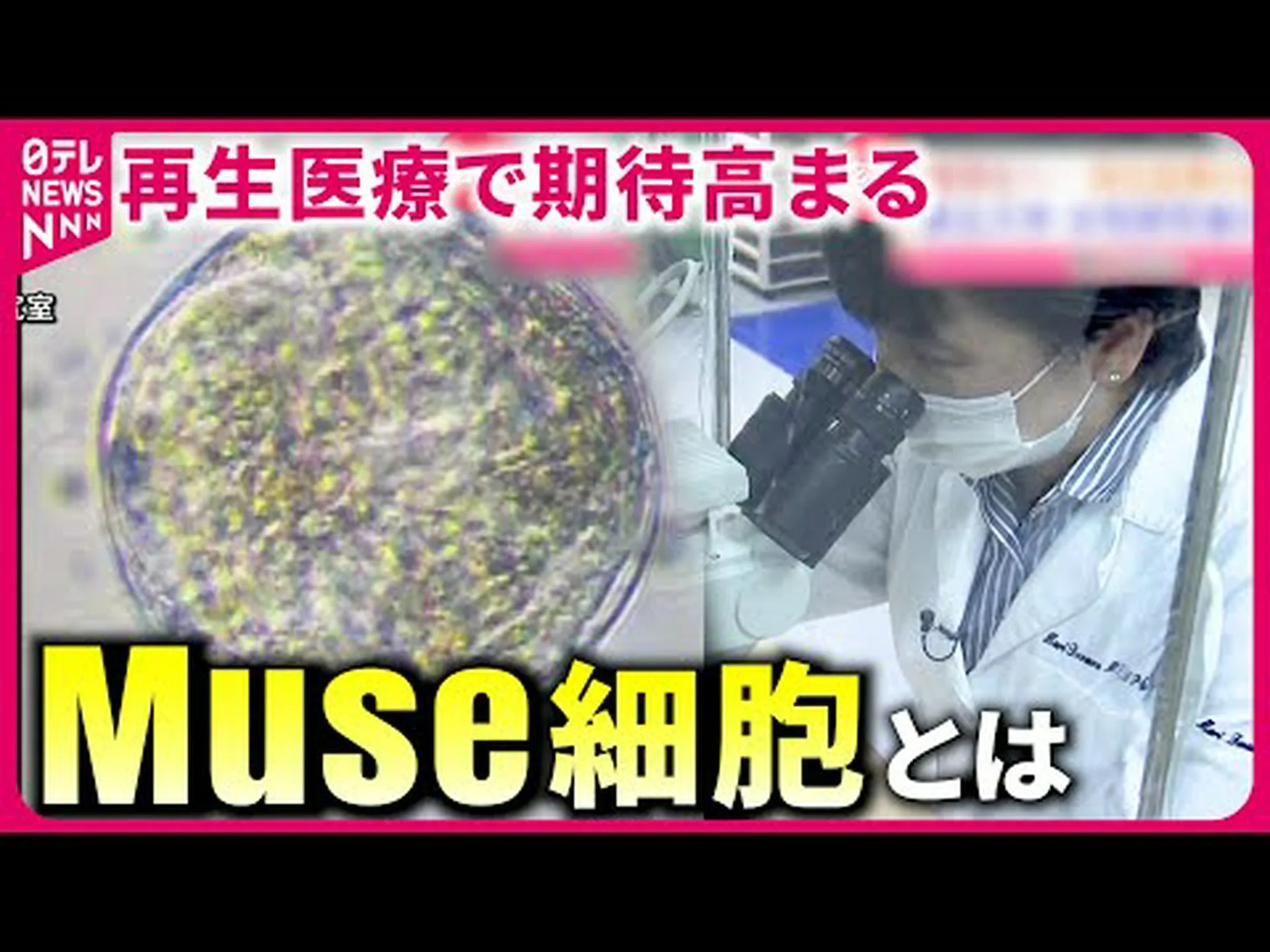 移植された幹細胞が脳内で活性化 移植された幹細胞が脳内で活性化