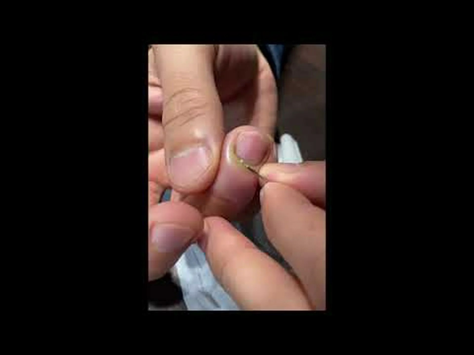 大きな鳥、大きなシラミ – 小さな鳥、小さなシラミ 大きな鳥、大きなシラミ – 小さな鳥、小さなシラミ