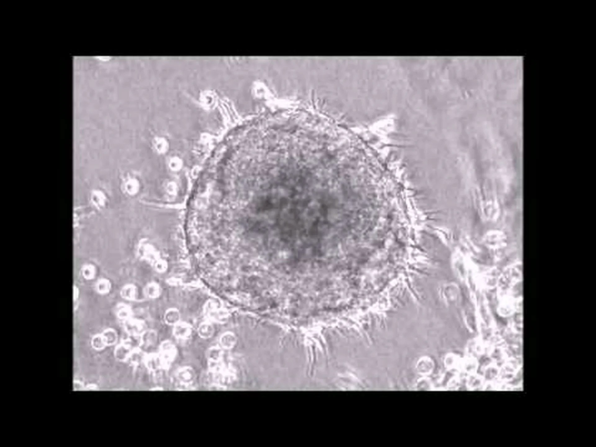 がん細胞が触手でくっつき合う がん細胞が触手でくっつき合う