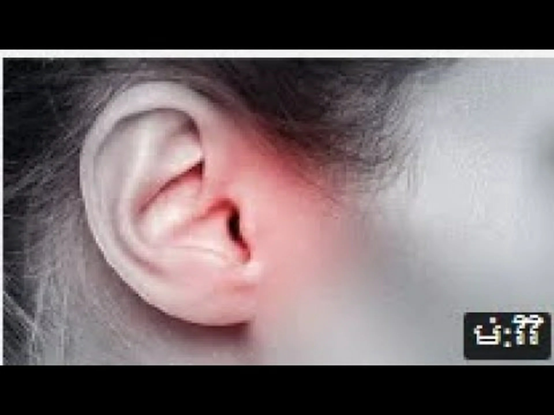 なぜ耳垢が存在するのでしょうか? なぜ耳垢が存在するのでしょうか?