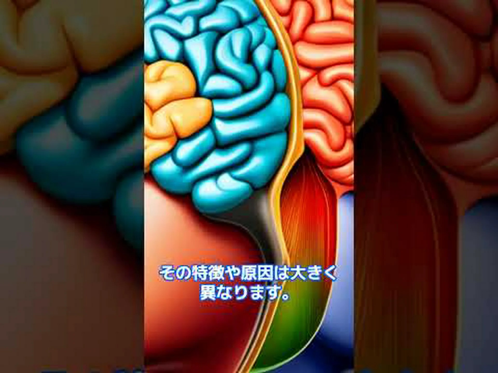 研究者: 片頭痛の予防効果は期間中に低下します 研究者: 片頭痛の予防効果は期間中に低下します