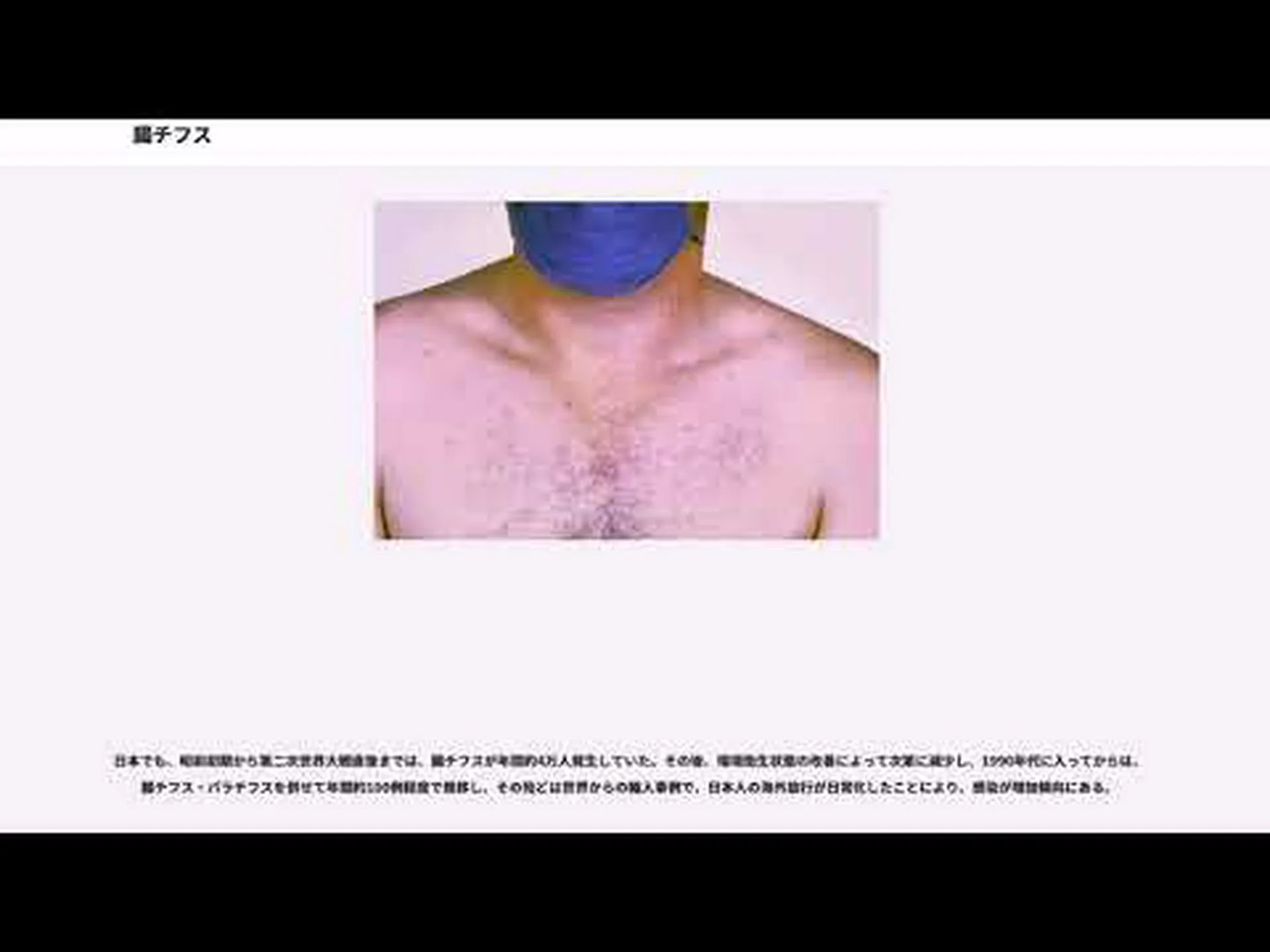 解読された腸チフス病原体の遺伝物質 解読された腸チフス病原体の遺伝物質