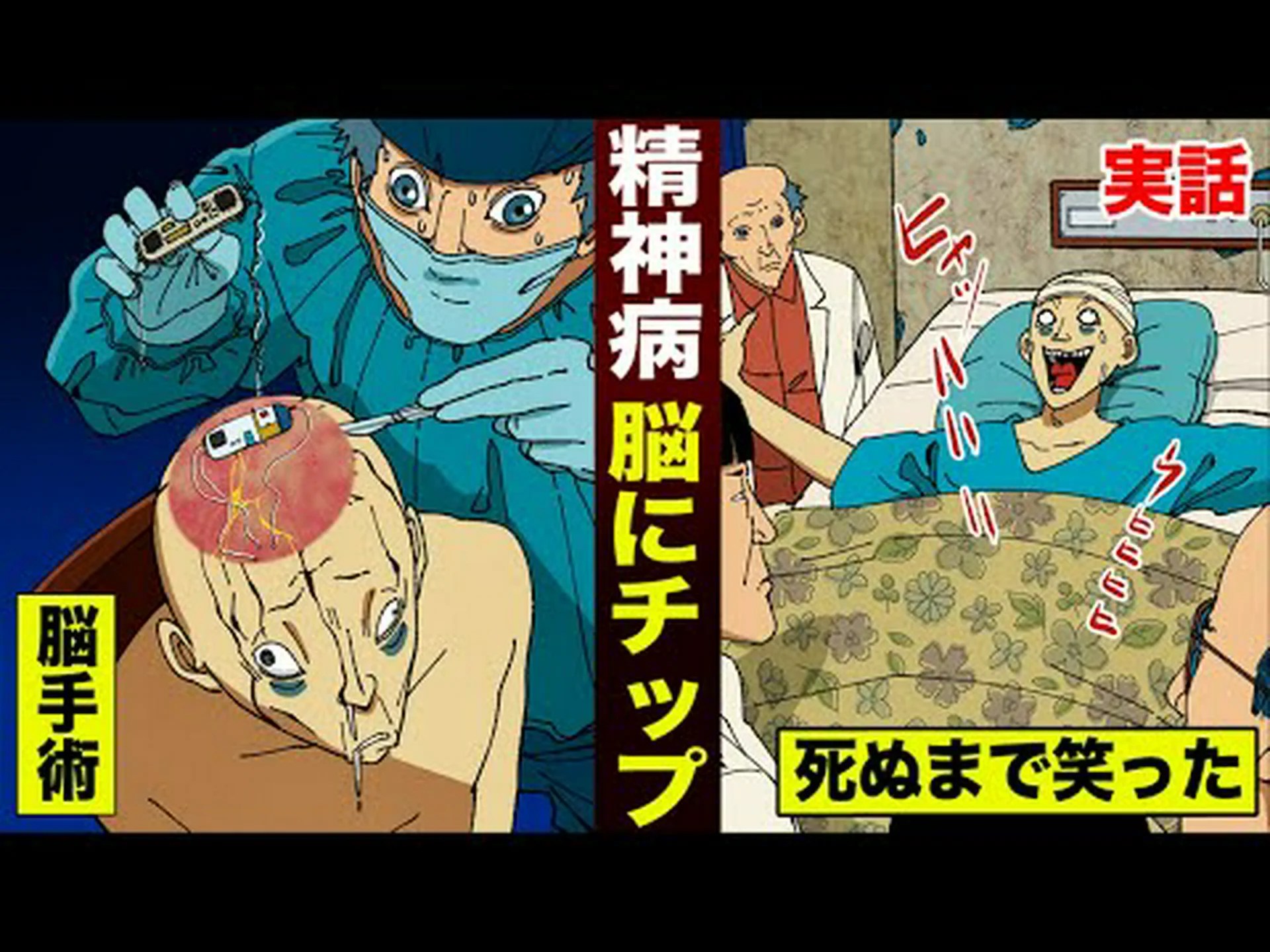 脳内の改造 脳内の改造