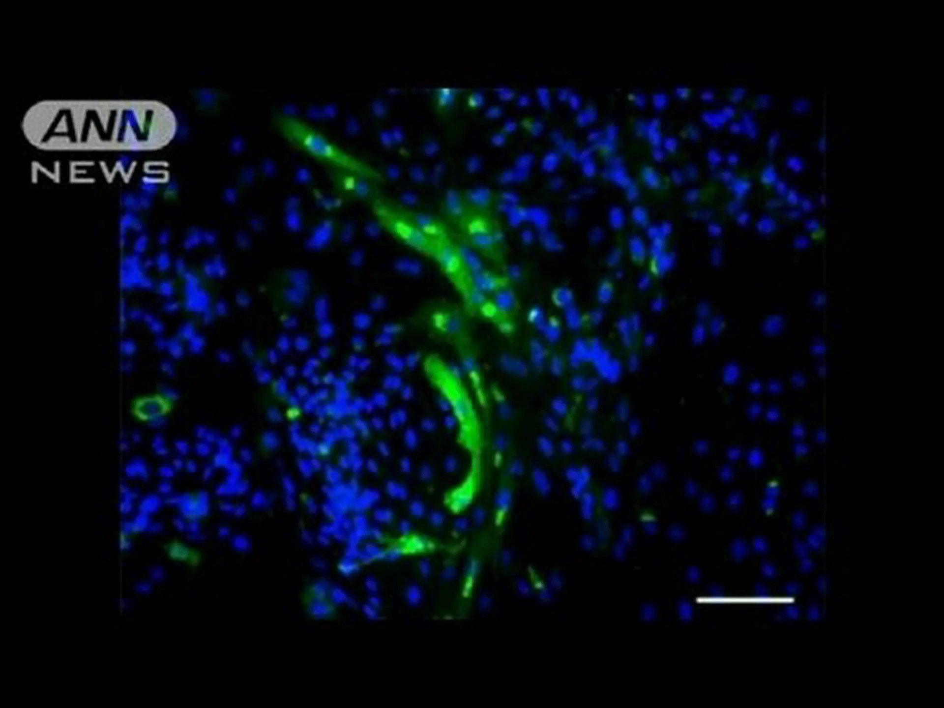 ヒト幹細胞から成長した機能的な腎臓 ヒト幹細胞から成長した機能的な腎臓