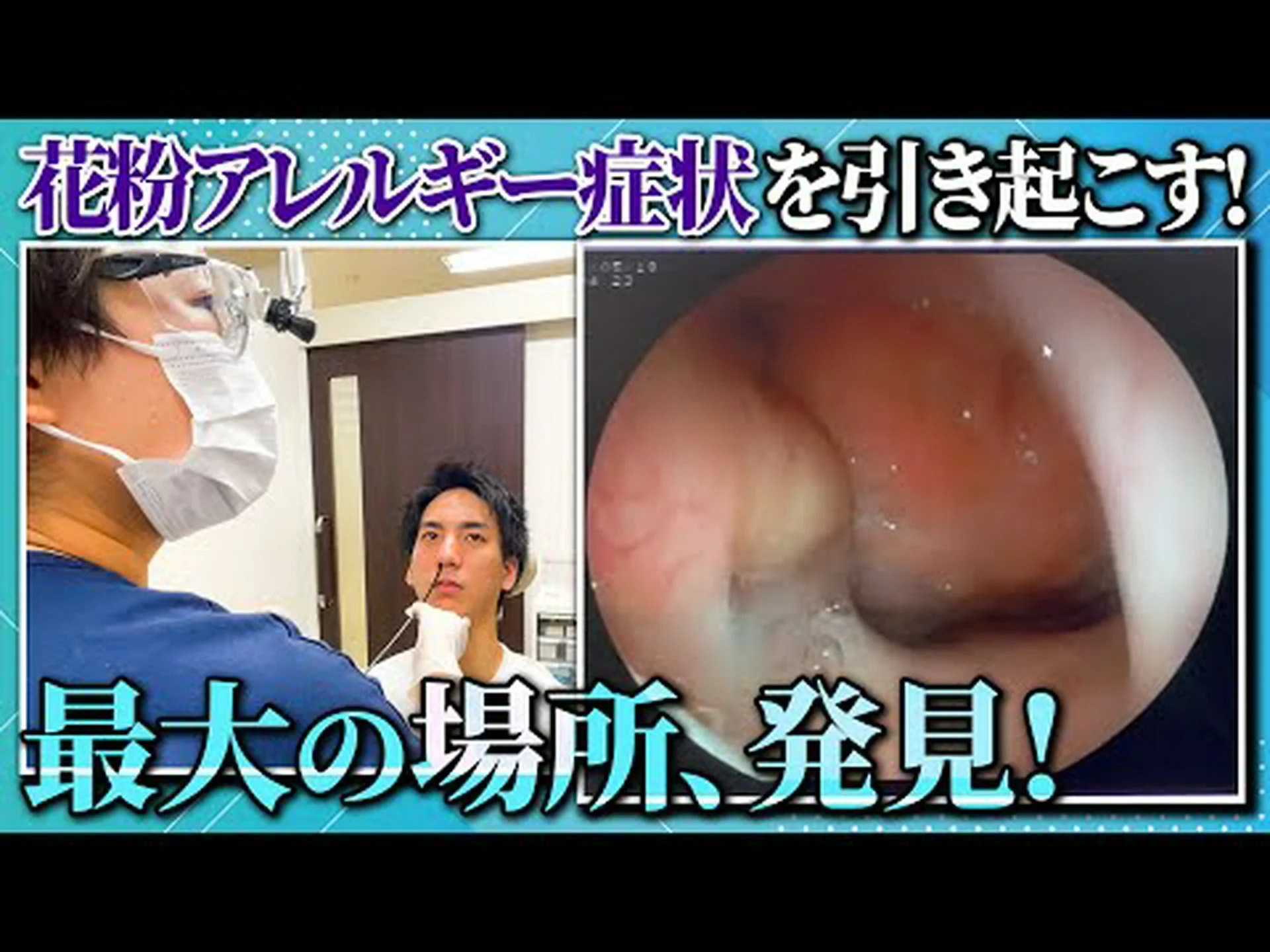 鼻の中の掃除の熱狂 鼻の中の掃除の熱狂