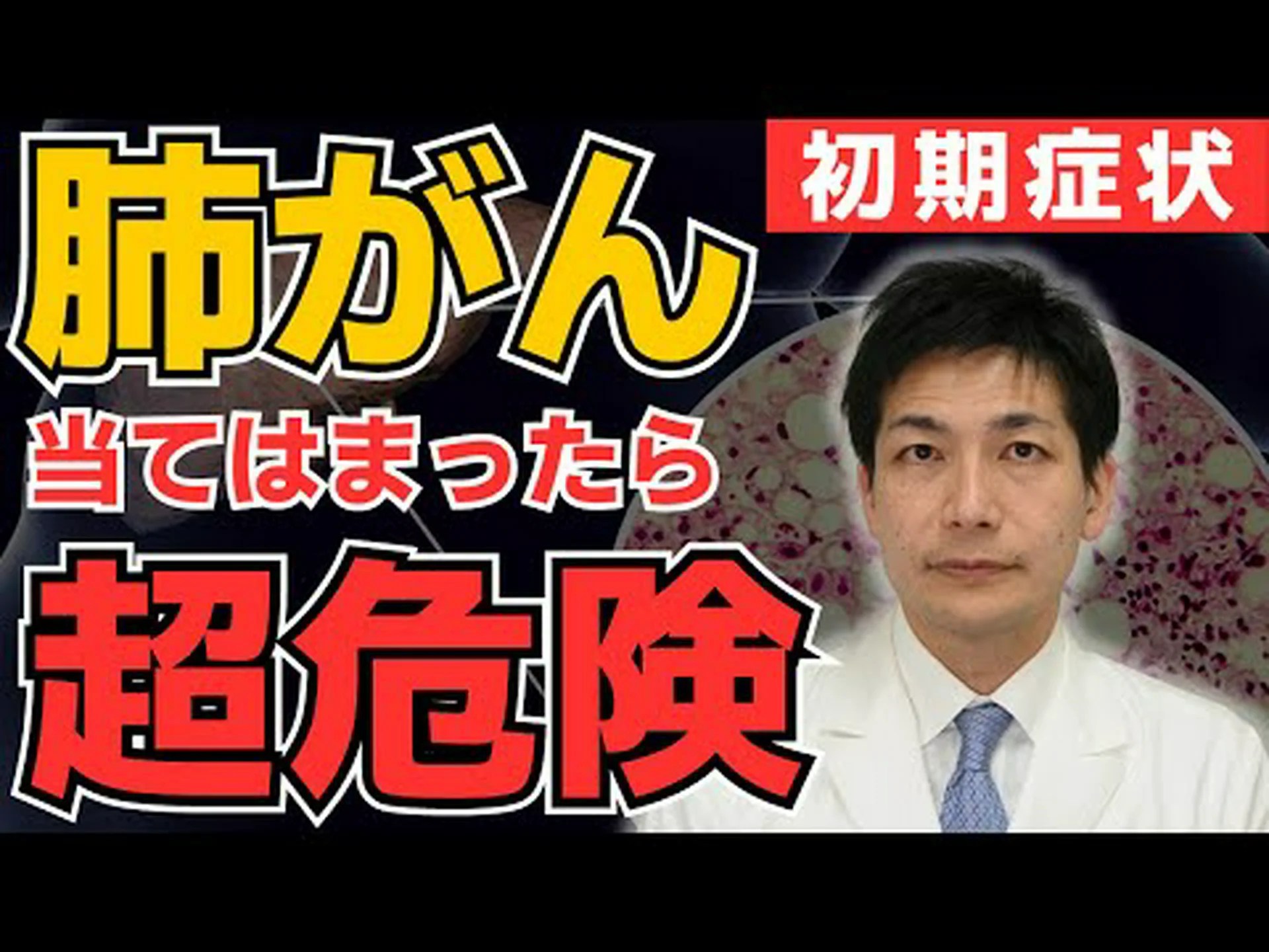 肺がん:男性の方が進行性が高い 肺がん:男性の方が進行性が高い