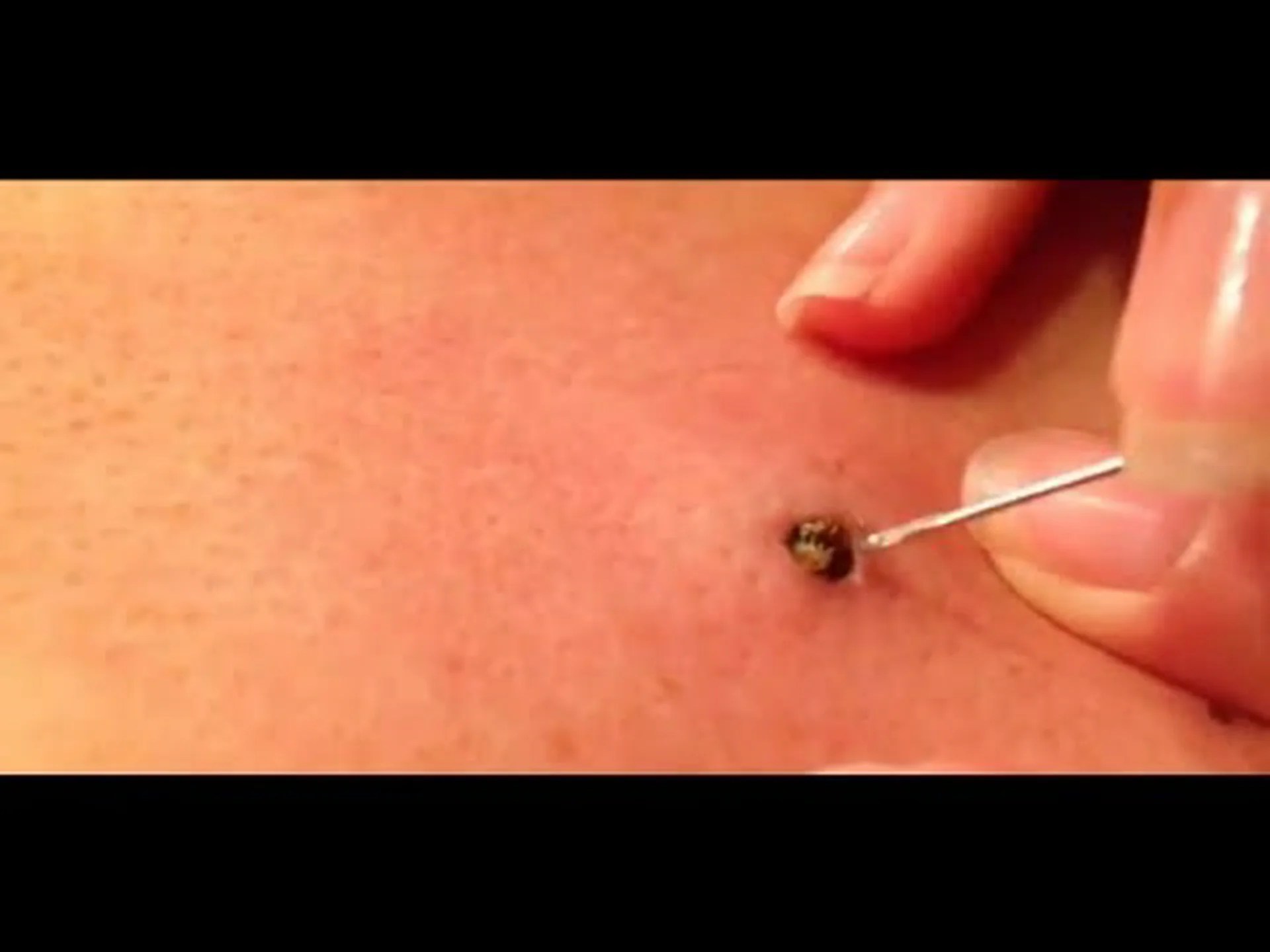 巨大昆虫の帰還 巨大昆虫の帰還