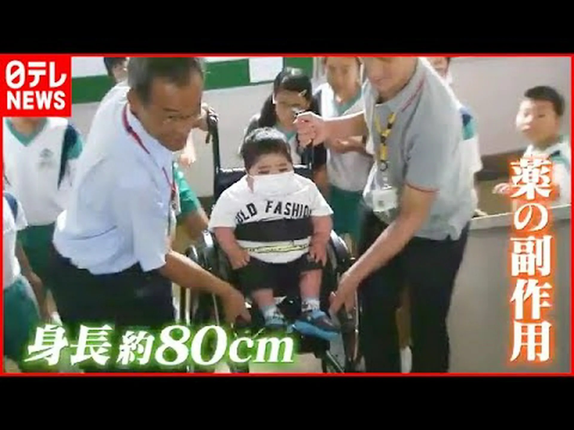 幼い頃から早老? 幼い頃から早老?