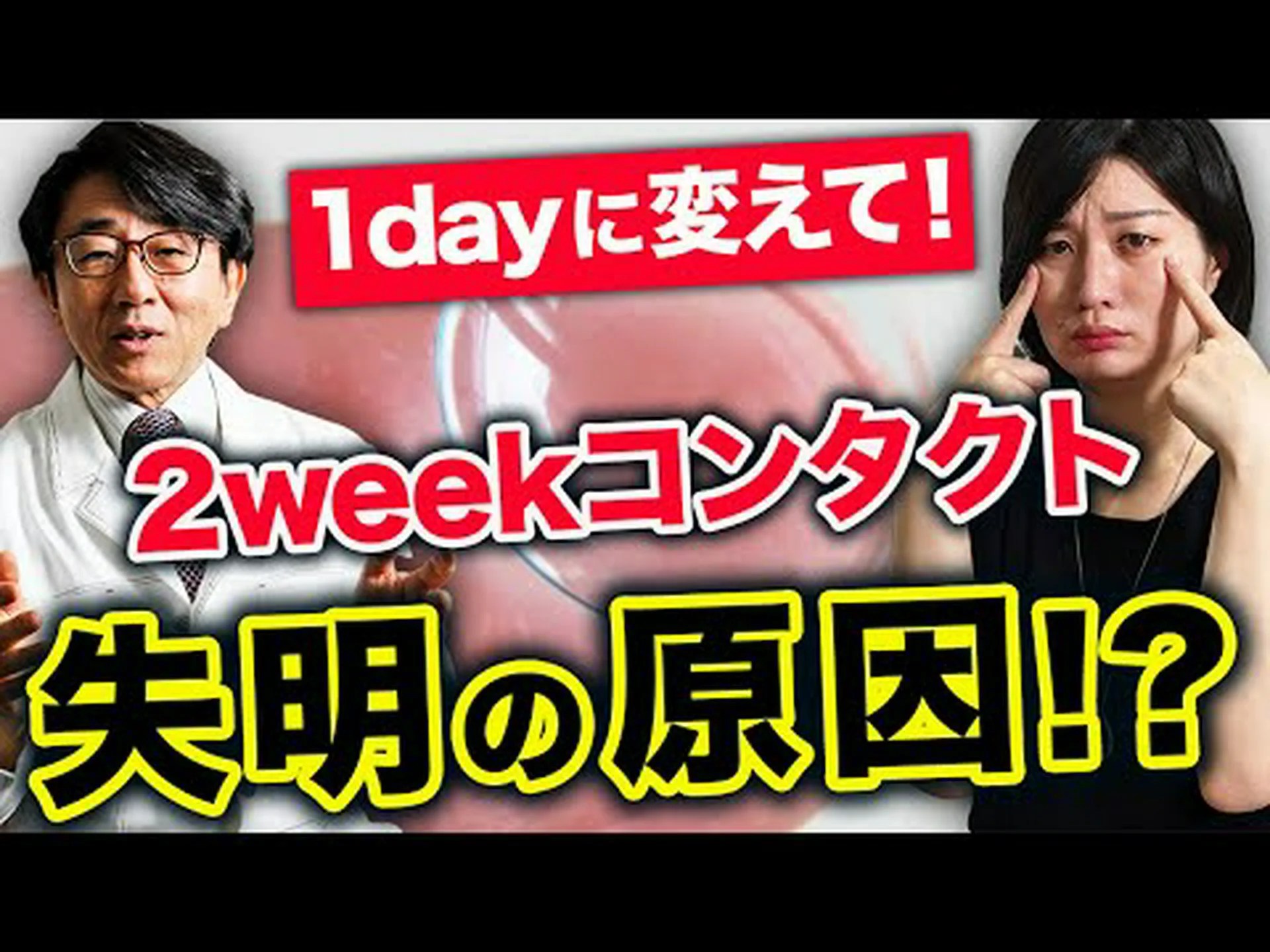 未来のコンタクトレンズは2か月間目に留まることができます 未来のコンタクトレンズは2か月間目に留まることができます