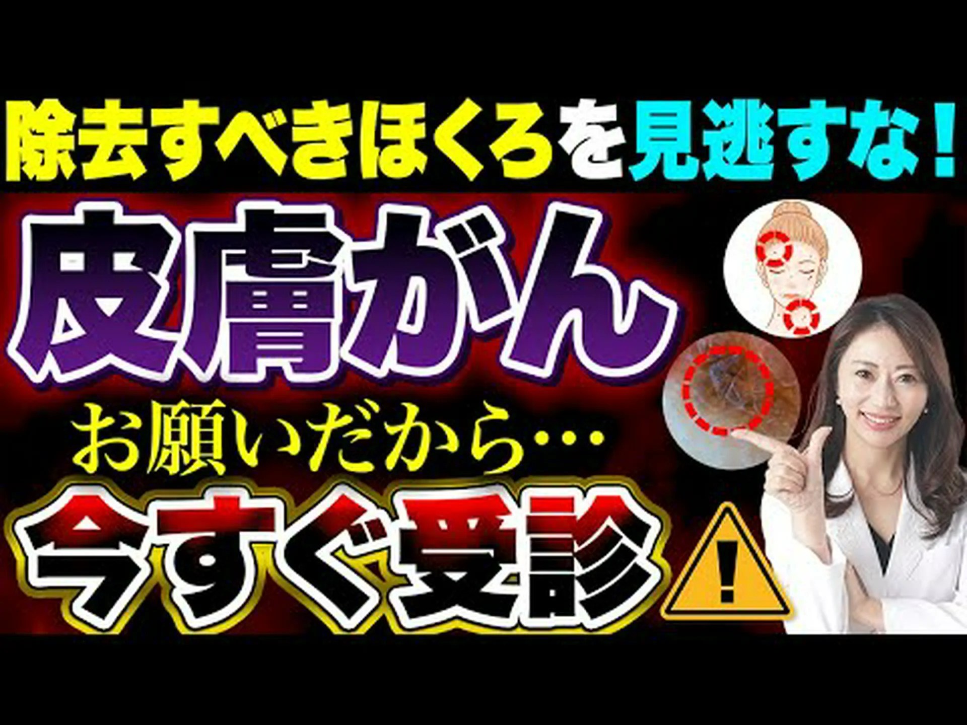 皮膚がん:暗闇でも太陽光は有害 皮膚がん:暗闇でも太陽光は有害