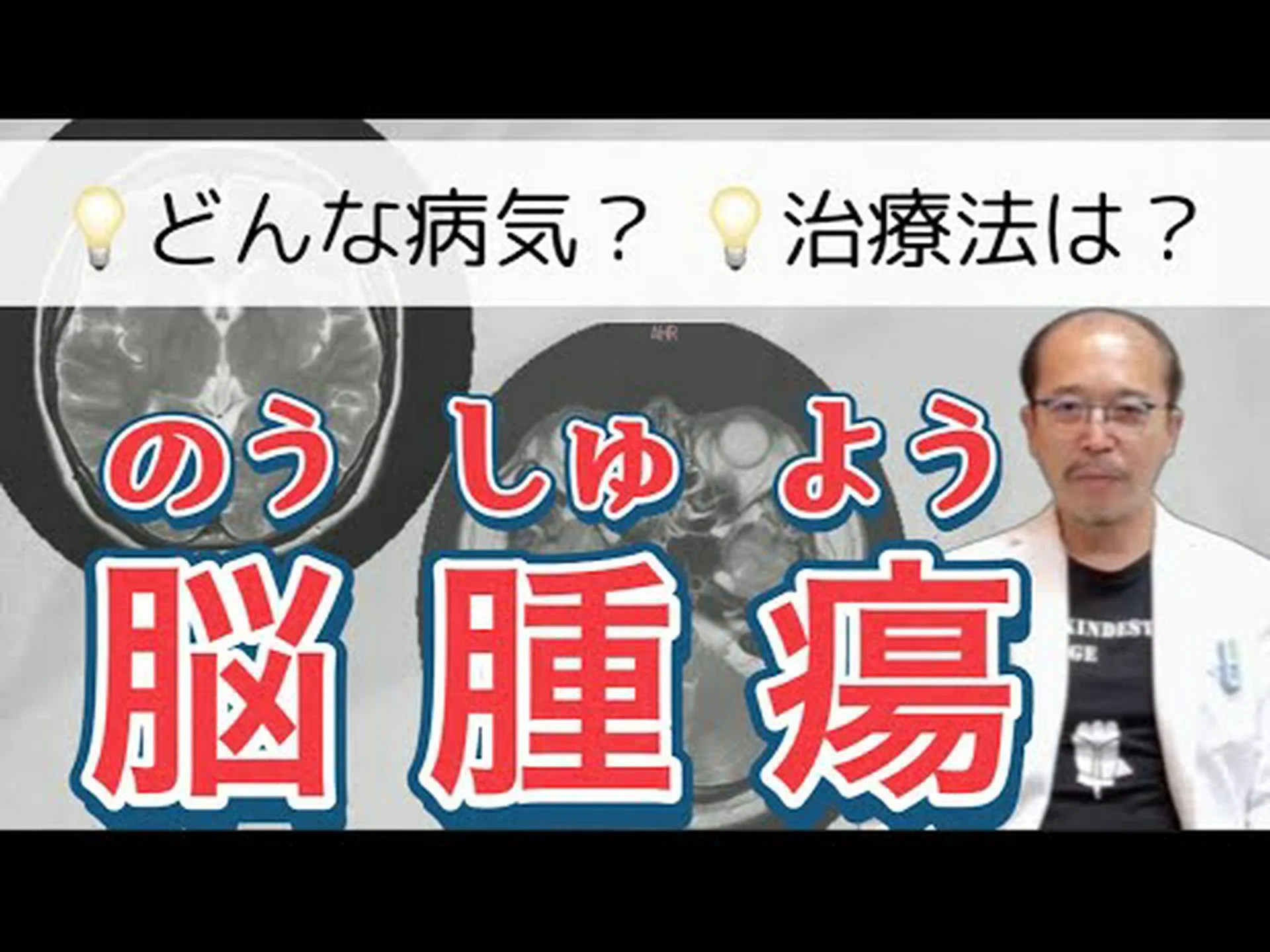 脳腫瘍をより正確に分類する 脳腫瘍をより正確に分類する