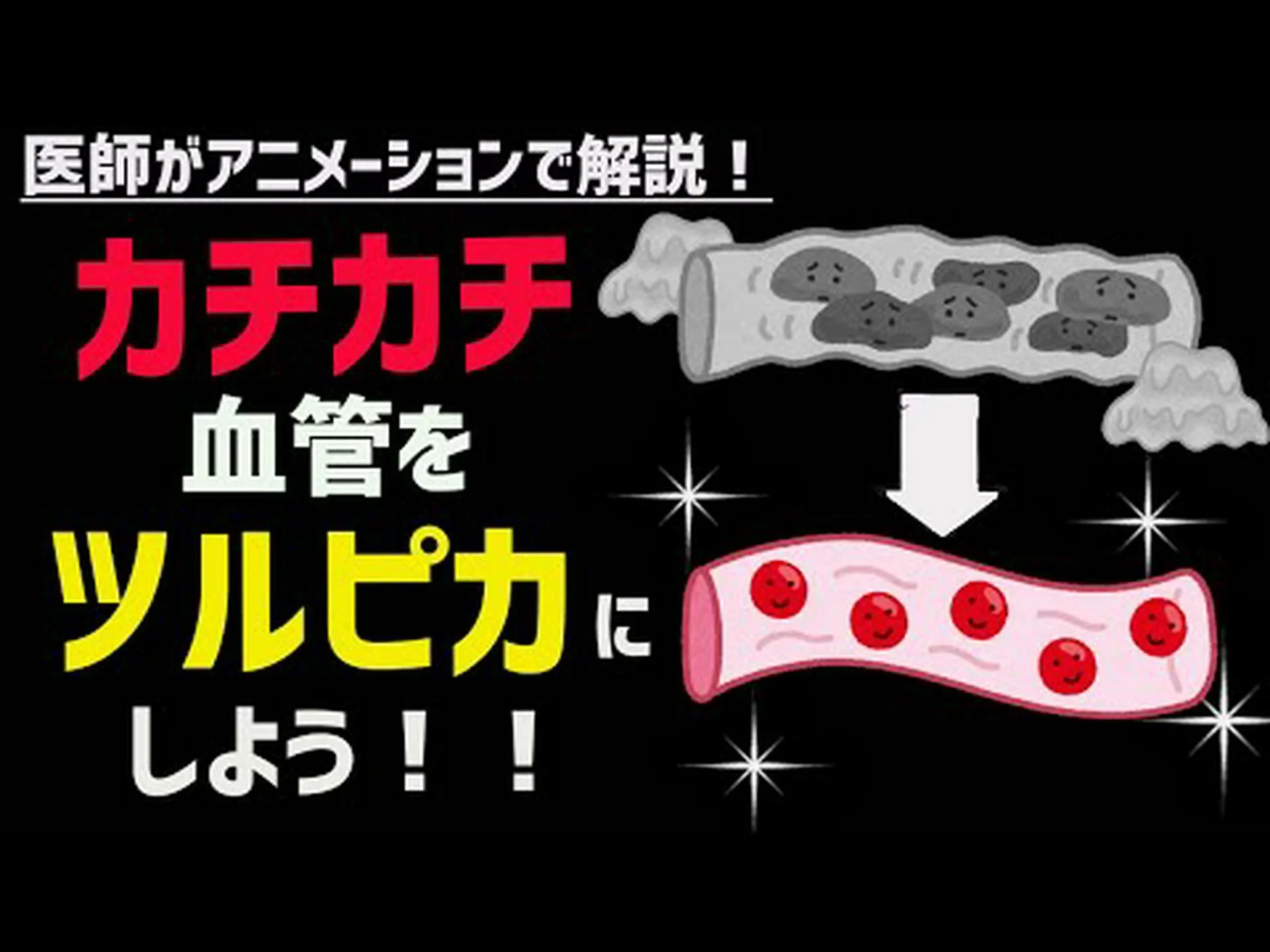 ミイラの動脈硬化の謎が解明される? ミイラの動脈硬化の謎が解明される?