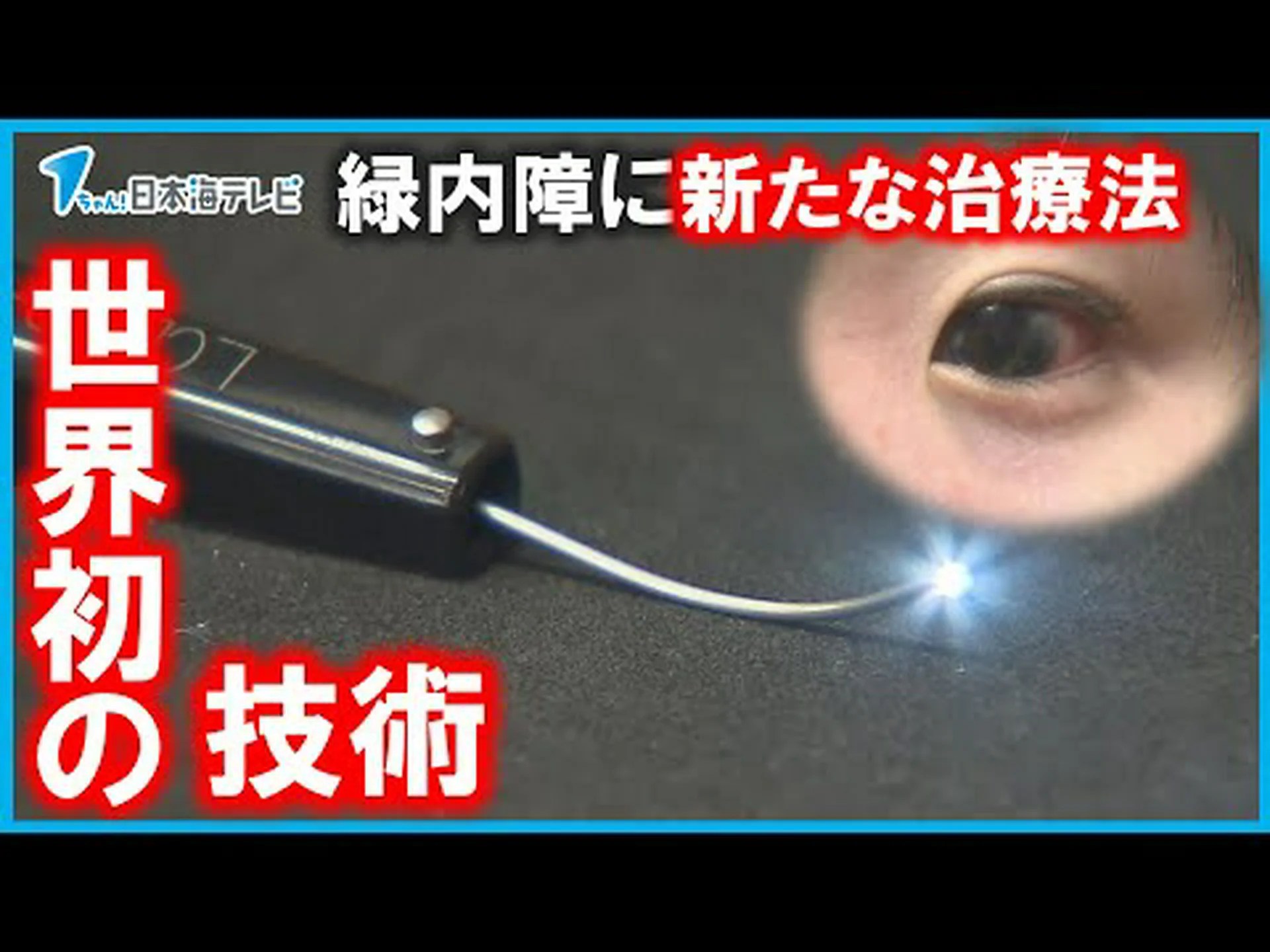 緑内障はすぐに治療する必要があります 緑内障はすぐに治療する必要があります