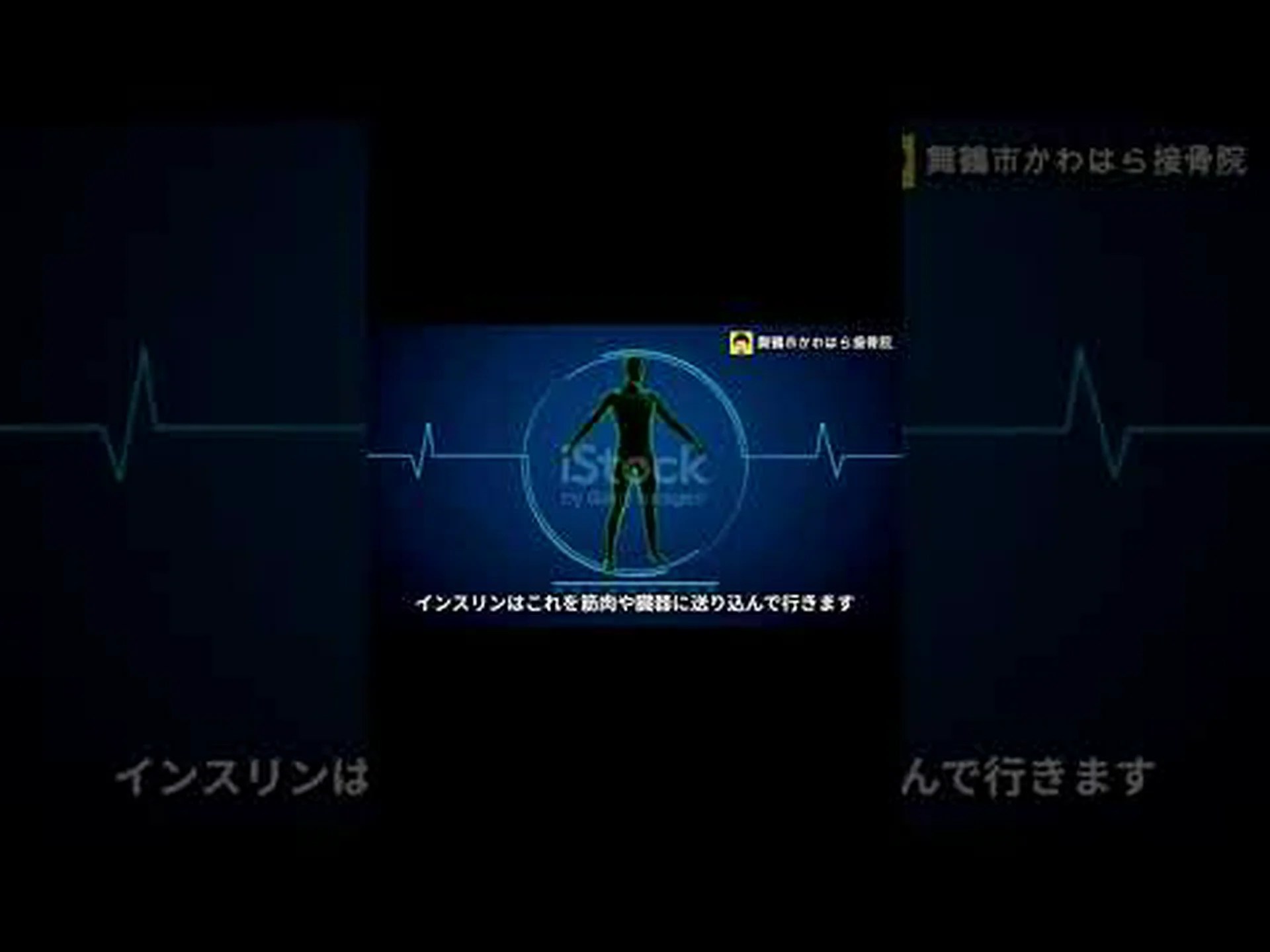 インスリン抵抗性に対するホルモンを発見 インスリン抵抗性に対するホルモンを発見