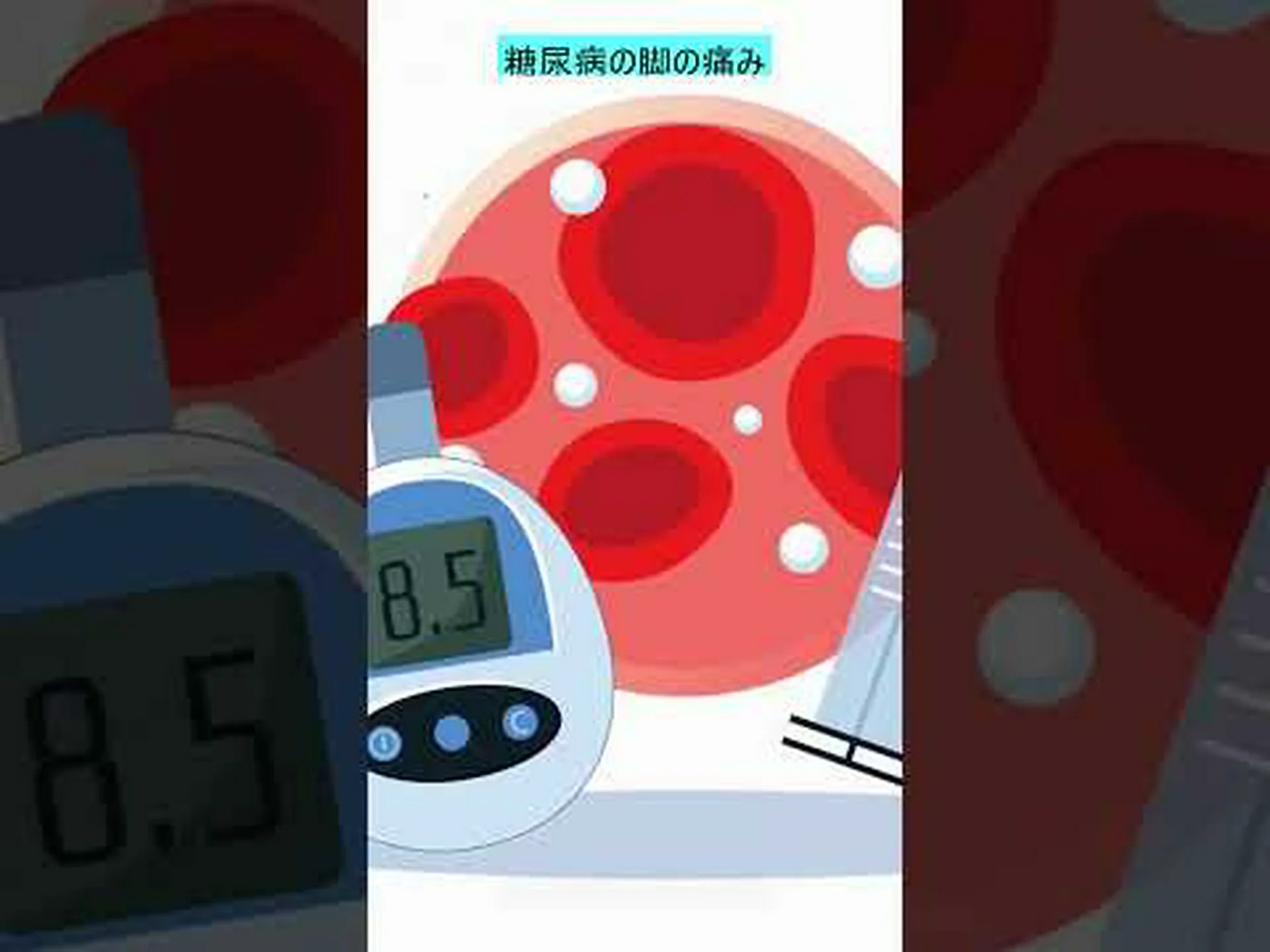 末梢神経障害 – それは何か、症状、治療、および家庭療法 末梢神経障害 – それは何か、症状、治療、および家庭療法