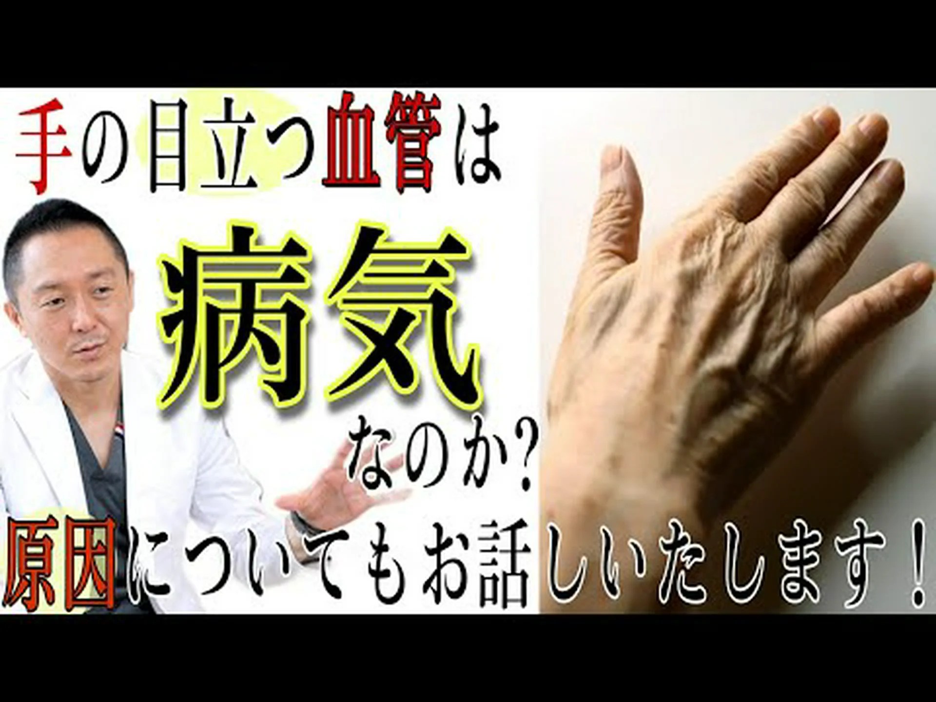 静脈を「浮き上がらせ」、血管の多い体にするための 8 つのヒント 静脈を「浮き上がらせ」、血管の多い体にするための 8 つのヒント
