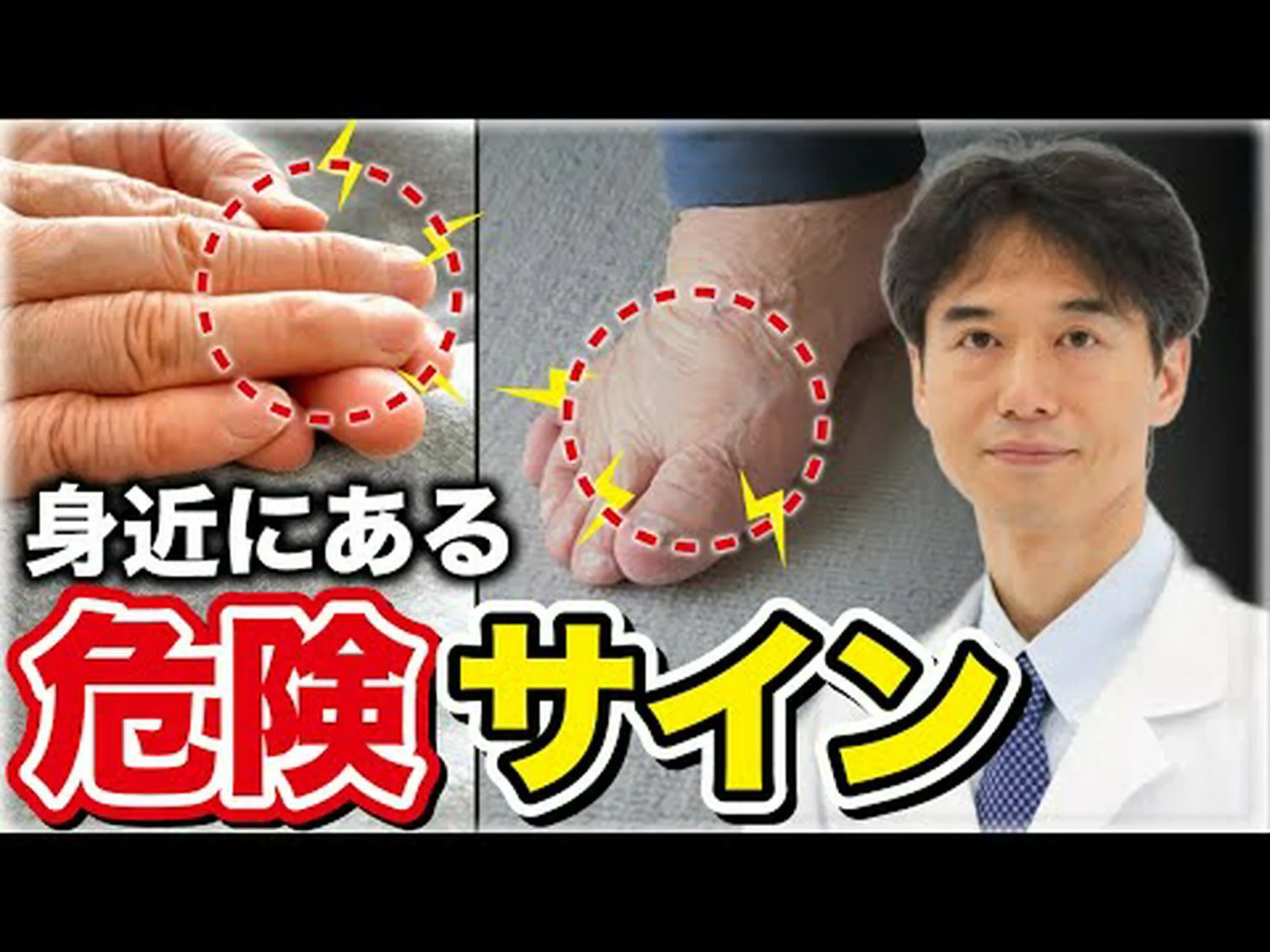 アルツハイマー病は腸の健康に関連している可能性があることが研究で判明 アルツハイマー病は腸の健康に関連している可能性があることが研究で判明