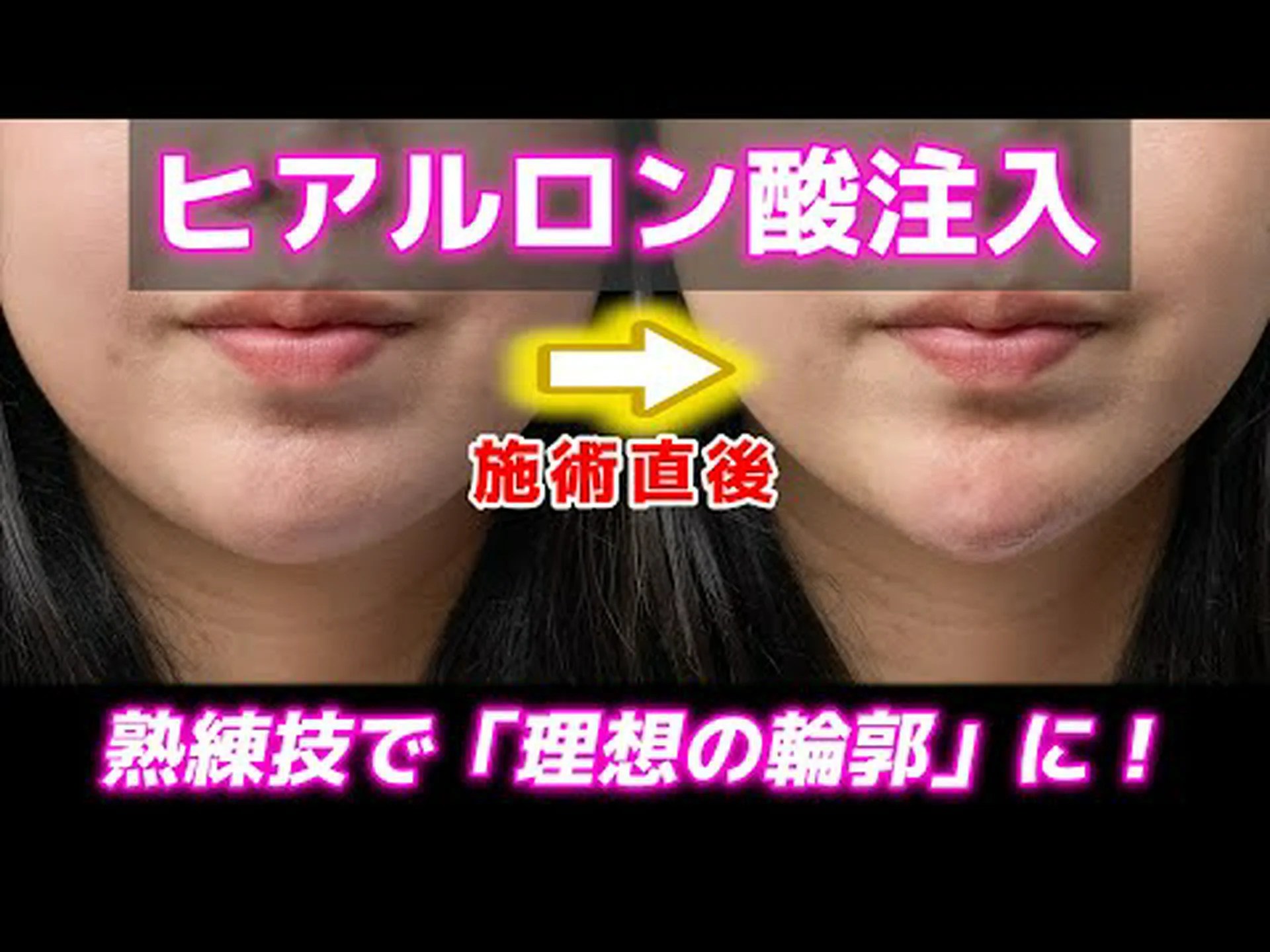 インフルエンサー、若さを保つために自分の血を飲んでいることを明かし、フォロワーに衝撃を与える インフルエンサー、若さを保つために自分の血を飲んでいることを明かし、フォロワーに衝撃を与える