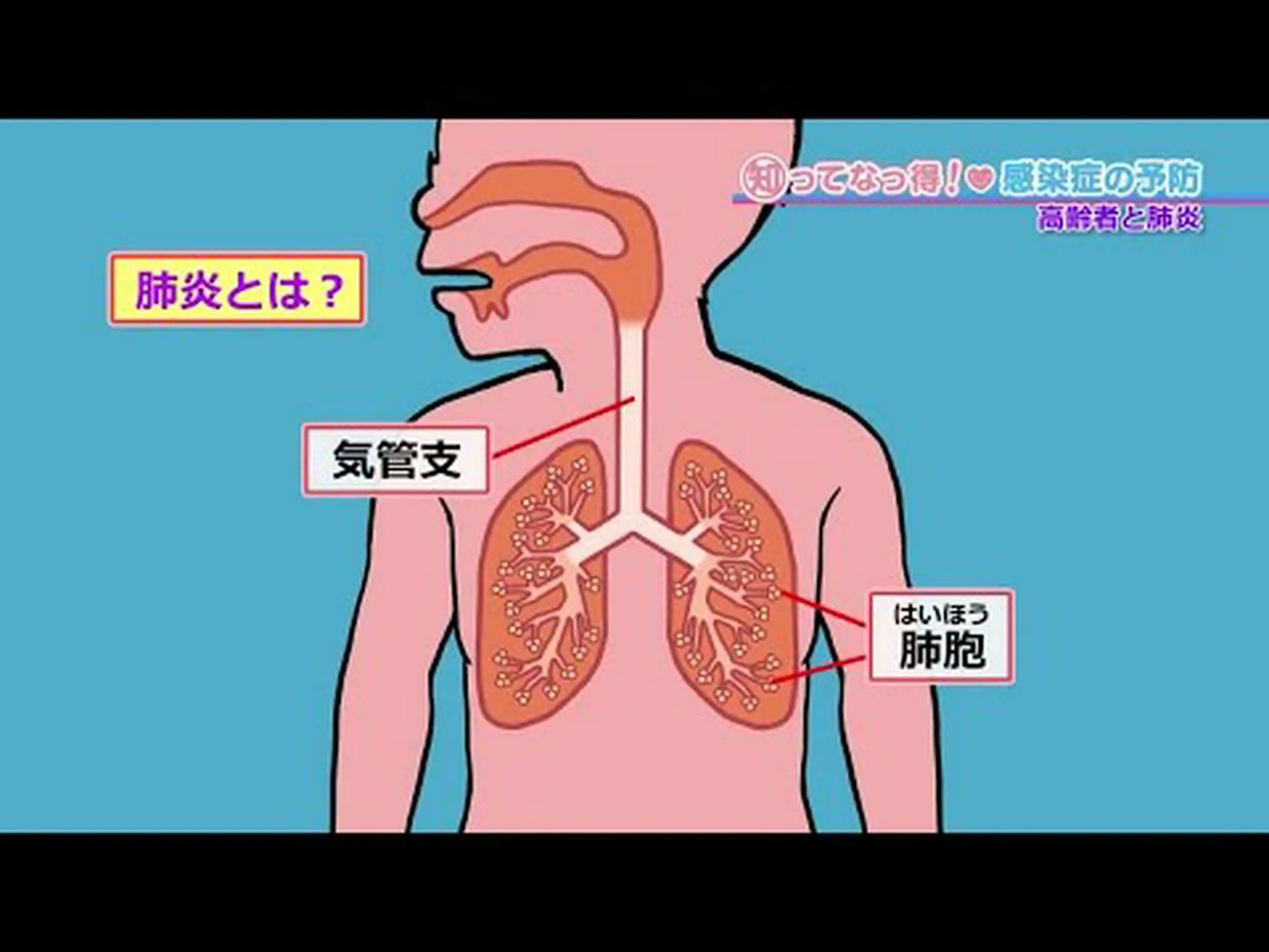 肺炎はどのように伝染するのか、またその予防法はどうすればよいのか 肺炎はどのように伝染するのか、またその予防法はどうすればよいのか
