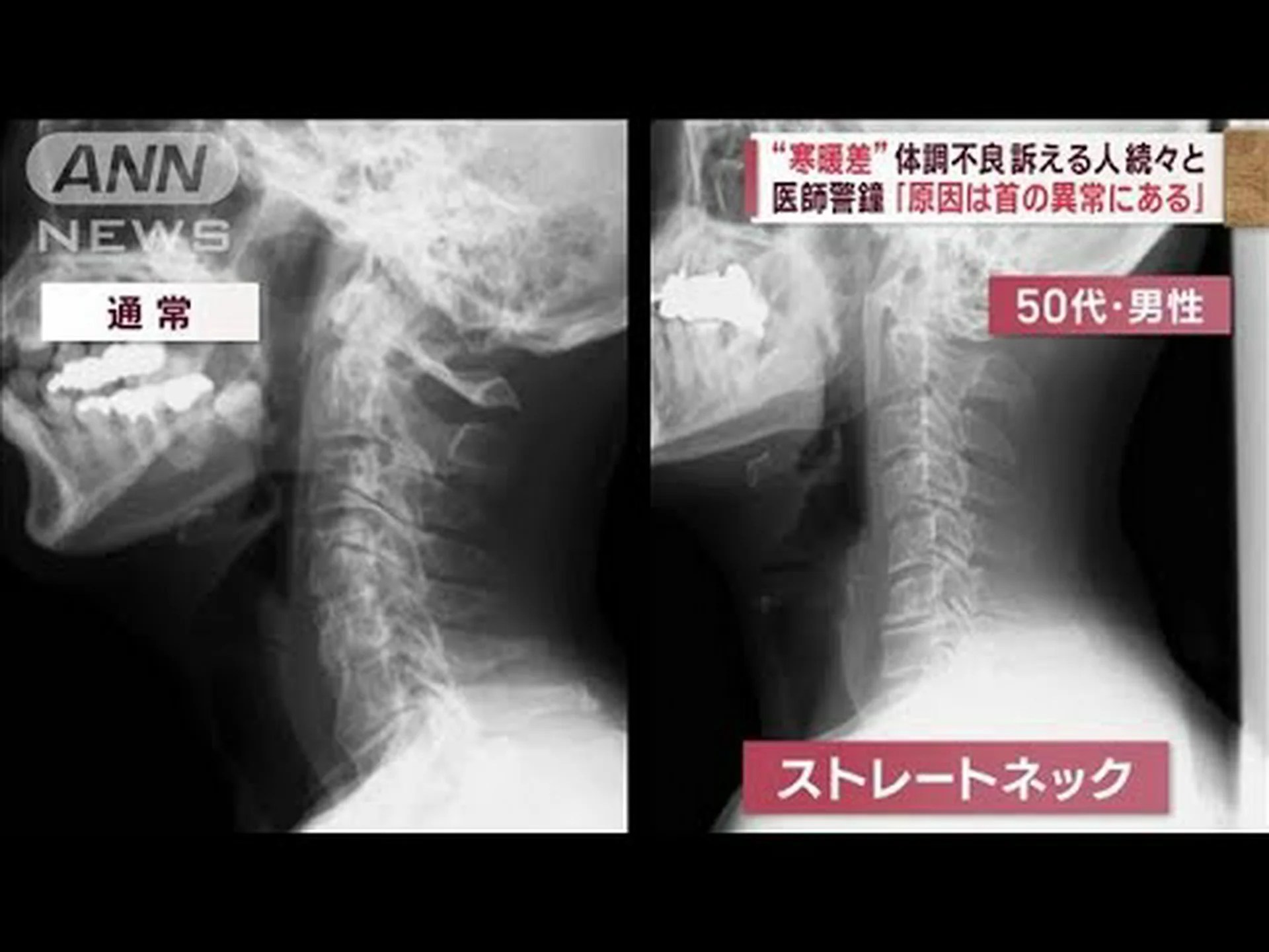 温度変化が体の痛みを引き起こす理由を知る 温度変化が体の痛みを引き起こす理由を知る