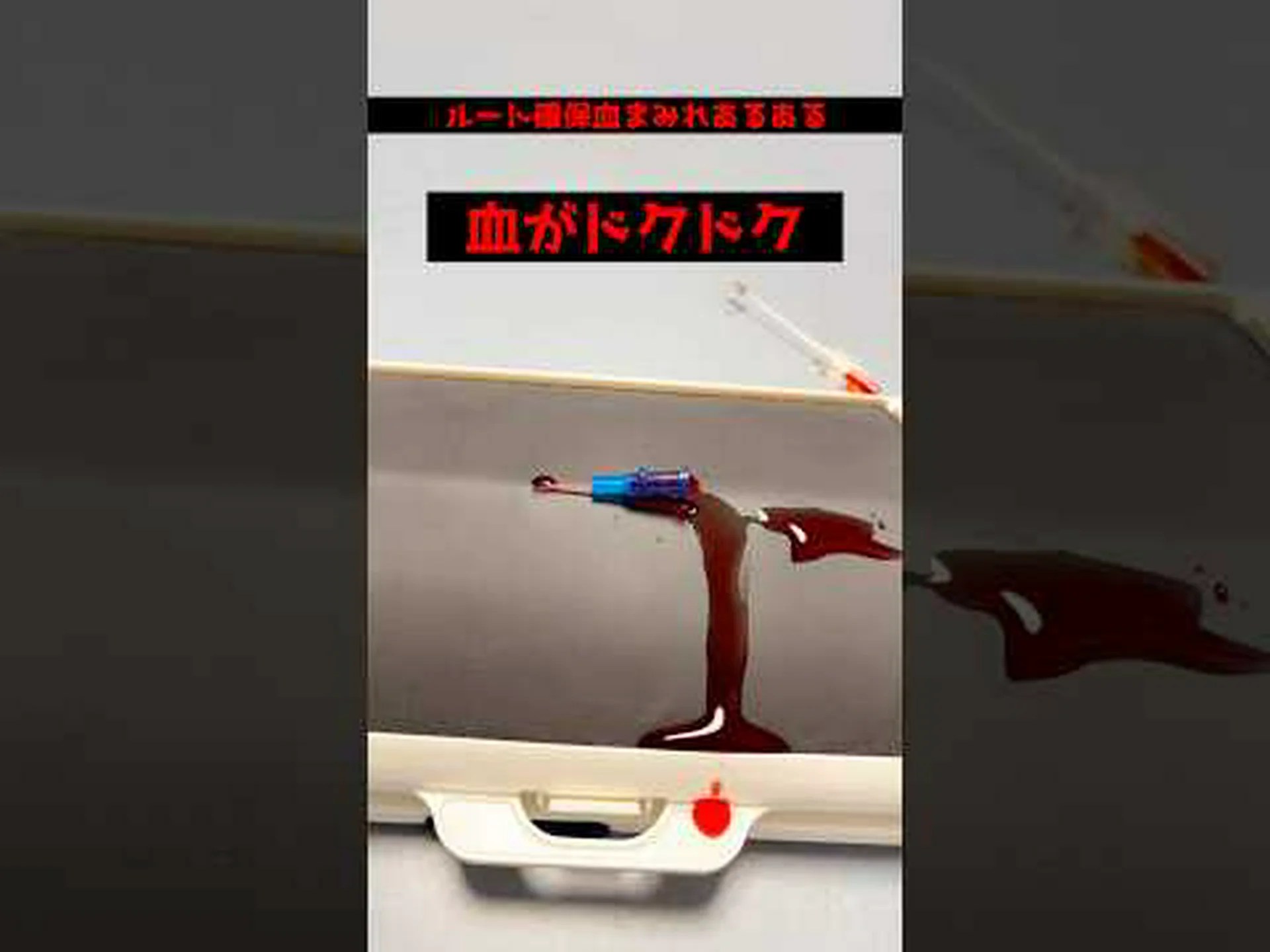 生焼けのベーコンを食べた男性、脳に虫の卵が溜まる 生焼けのベーコンを食べた男性、脳に虫の卵が溜まる