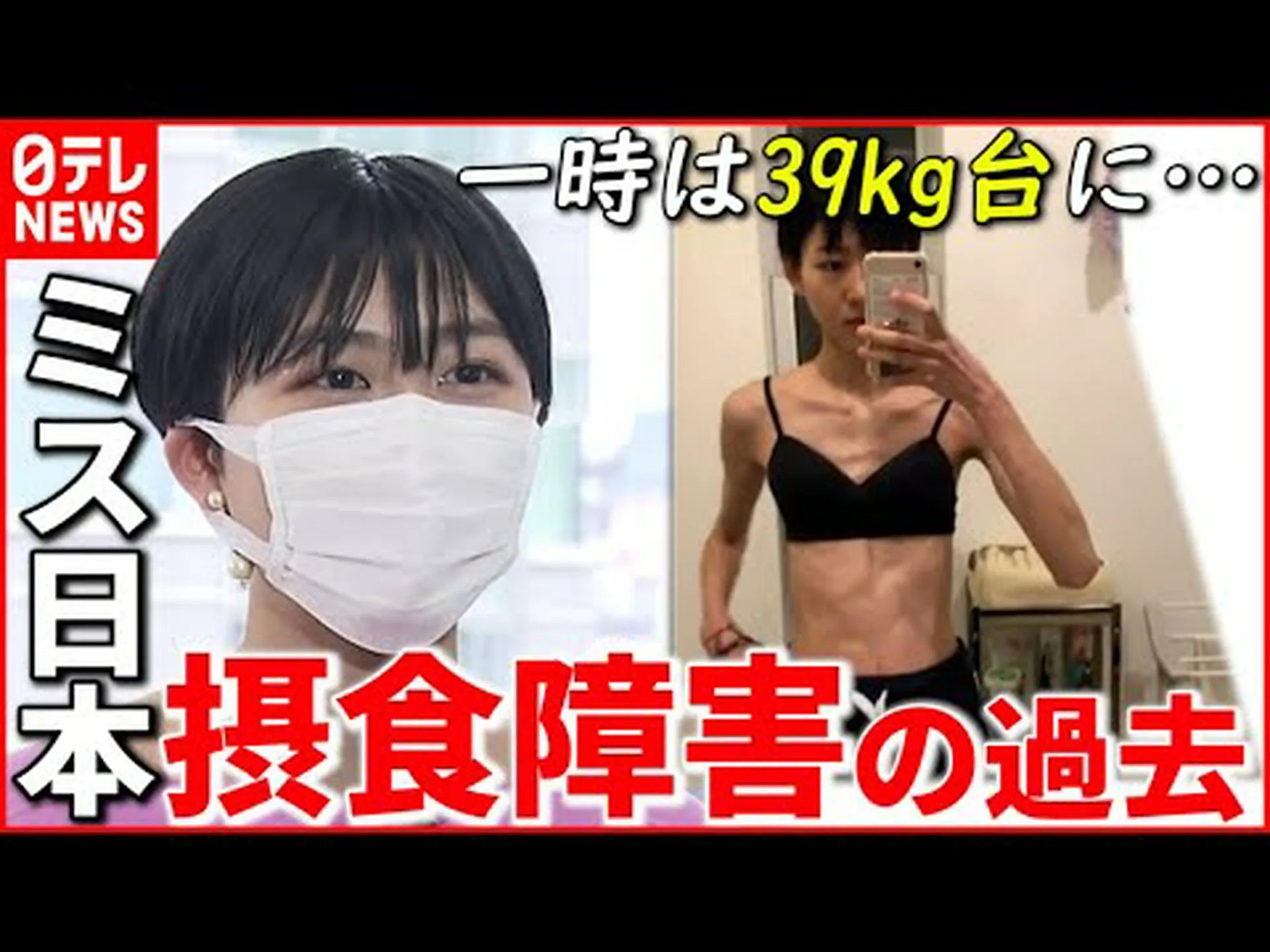 夫が自殺した後、彼女は摂食強迫を克服し、40kg減量した 夫が自殺した後、彼女は摂食強迫を克服し、40kg減量した