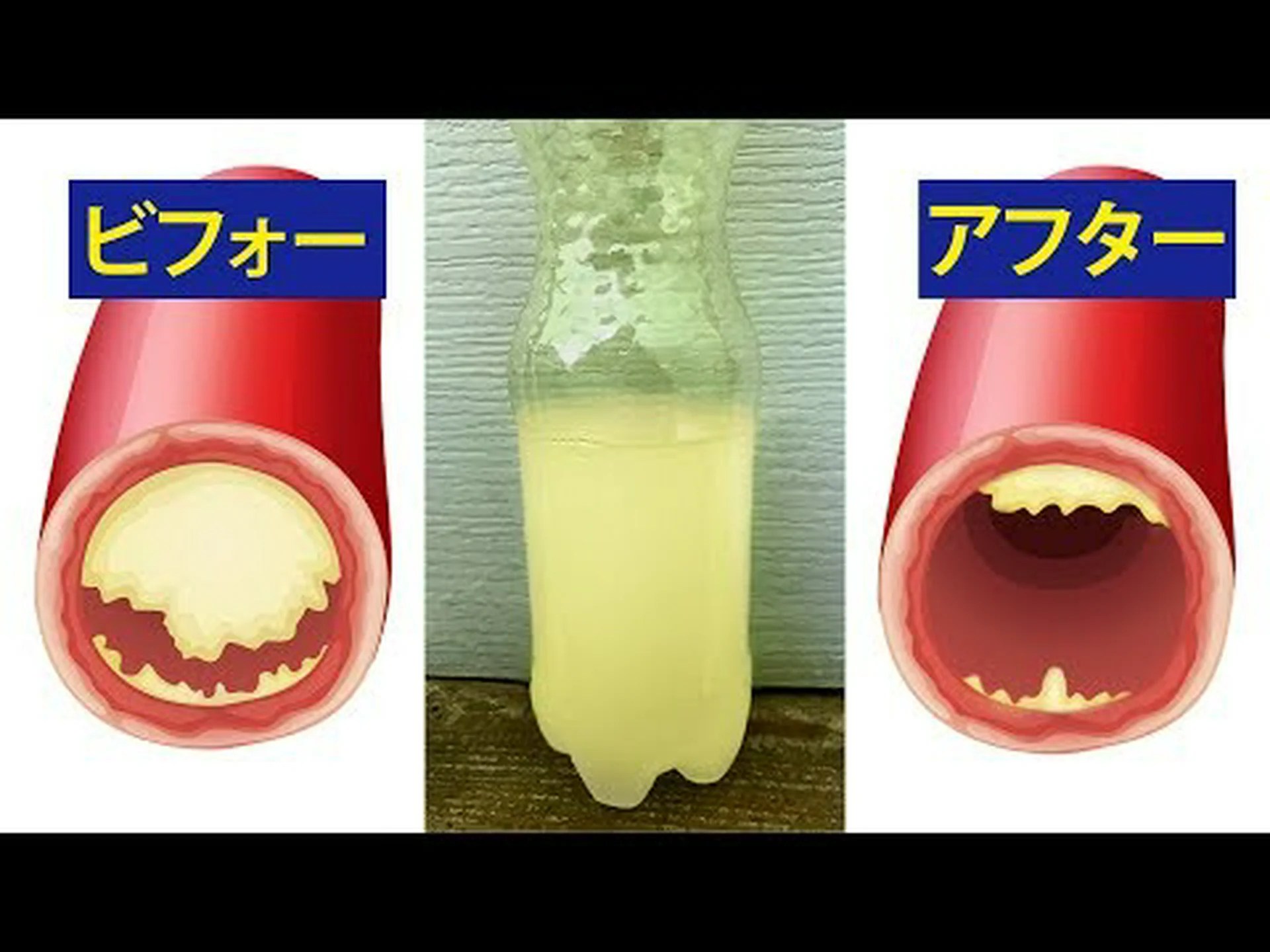 科学によると、心臓発作を防ぐ10の食品 科学によると、心臓発作を防ぐ10の食品