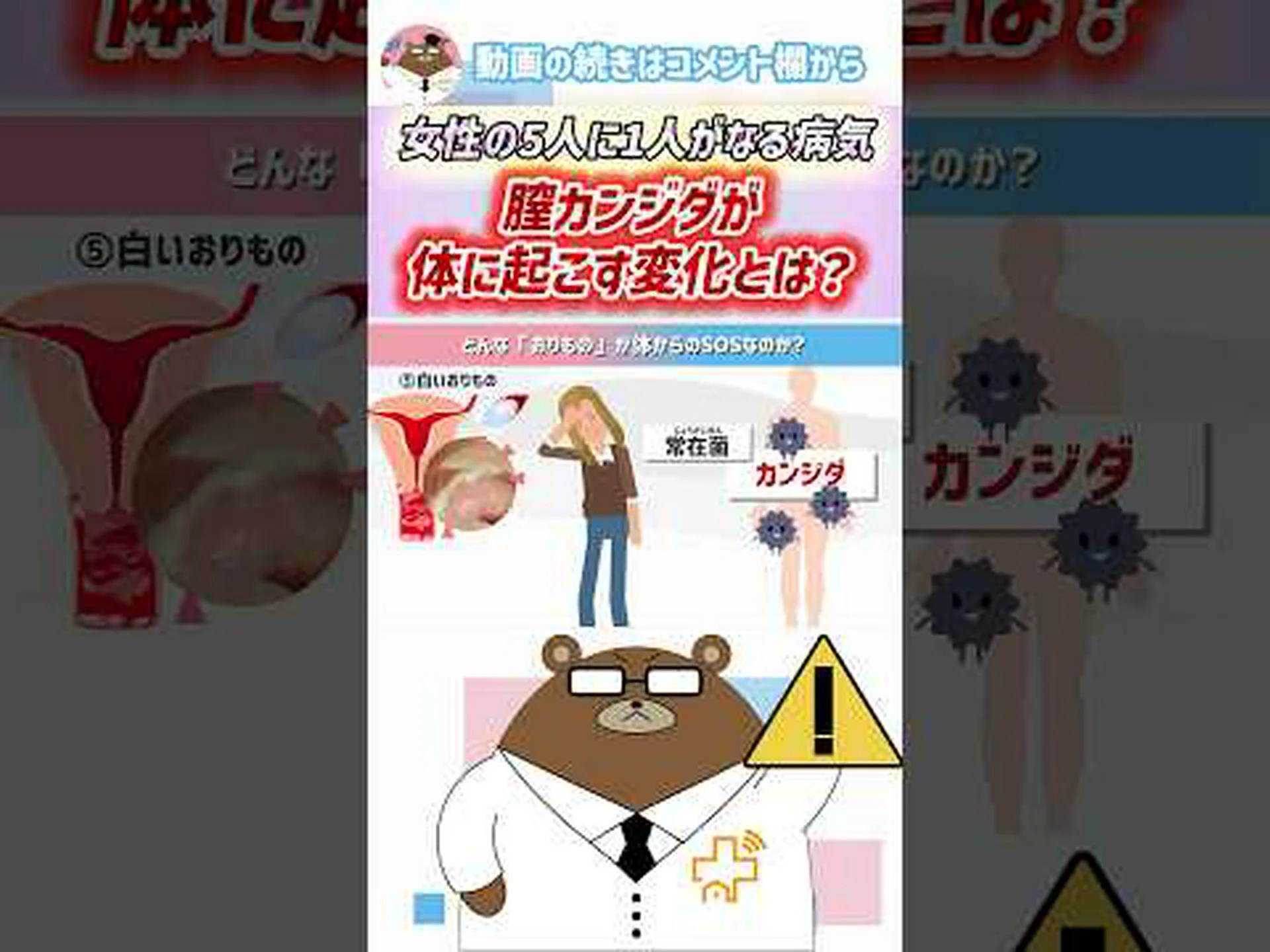 カンジダ症と混同されやすい5つの症状 カンジダ症と混同されやすい5つの症状