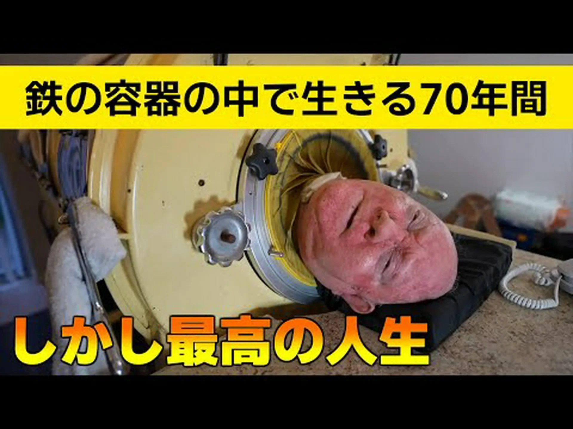 70年間「鉄の肺」の中で生きてきた男性が新型コロナウイルスで死亡 70年間「鉄の肺」の中で生きてきた男性が新型コロナウイルスで死亡