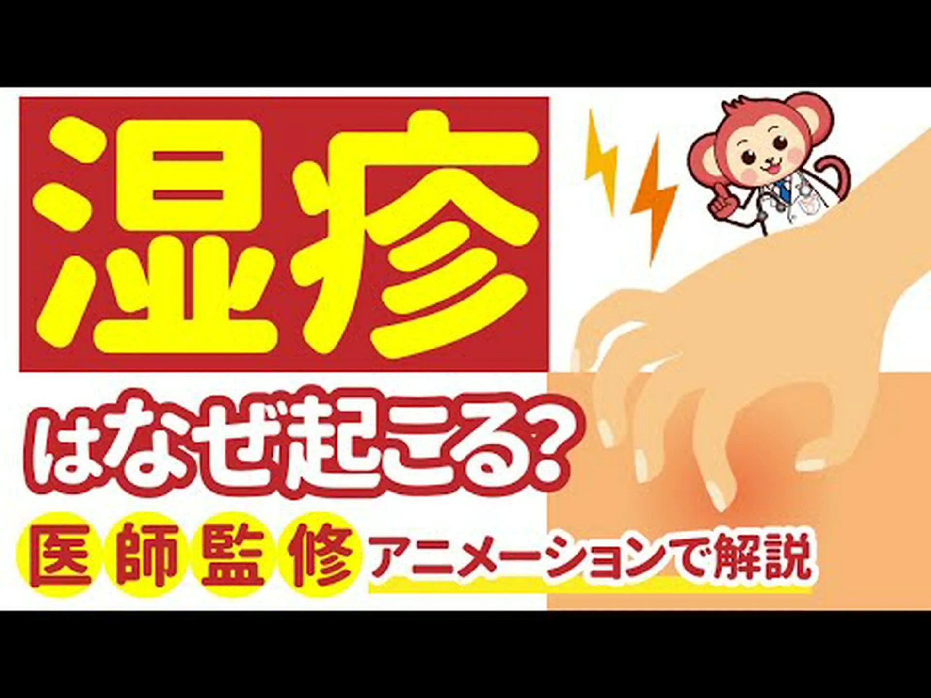 体のかゆみ:4つの主な原因と対処法 体のかゆみ:4つの主な原因と対処法