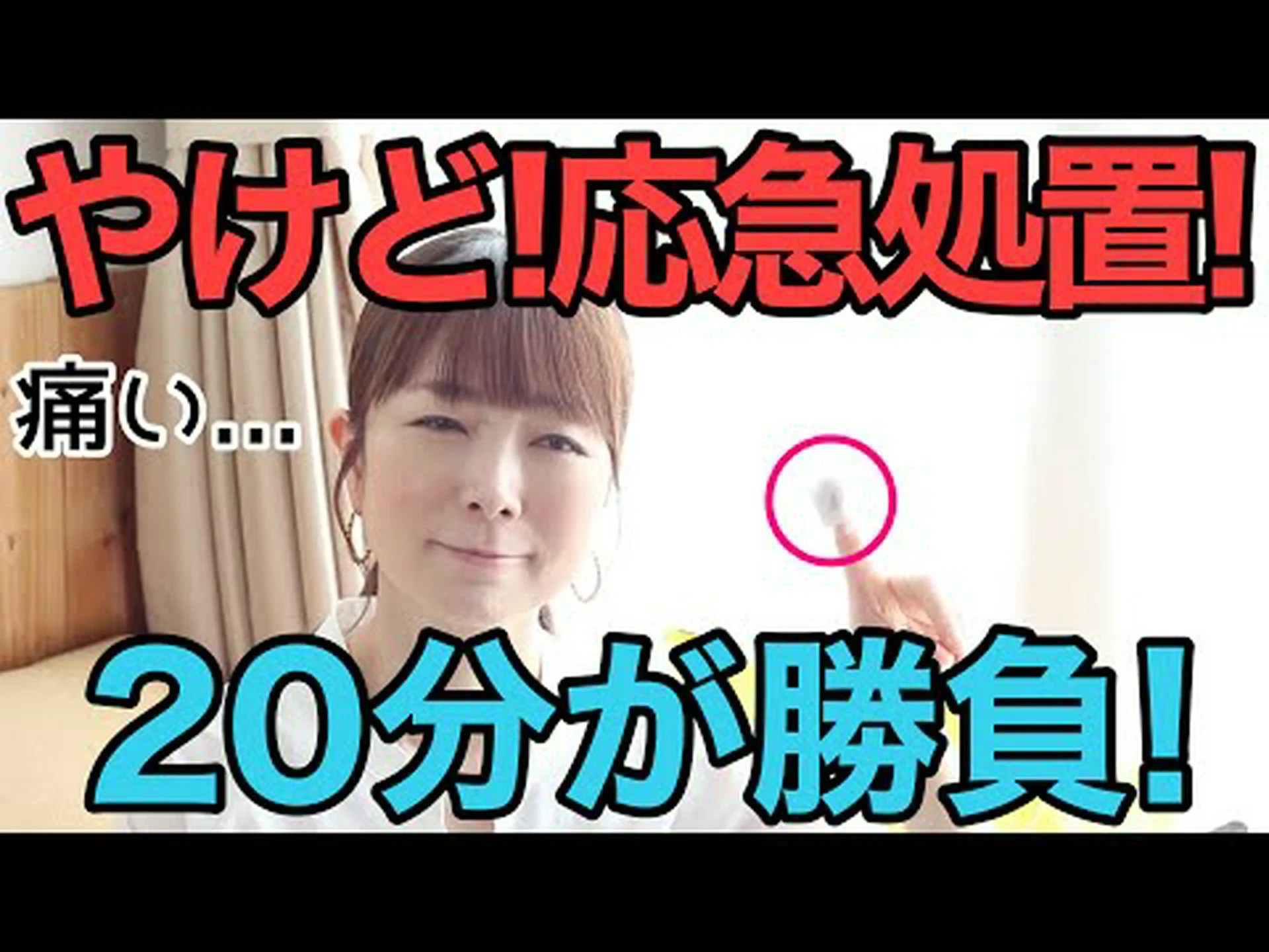 体の40%を火傷した青年が予防法を披露すると話題に 体の40%を火傷した青年が予防法を披露すると話題に