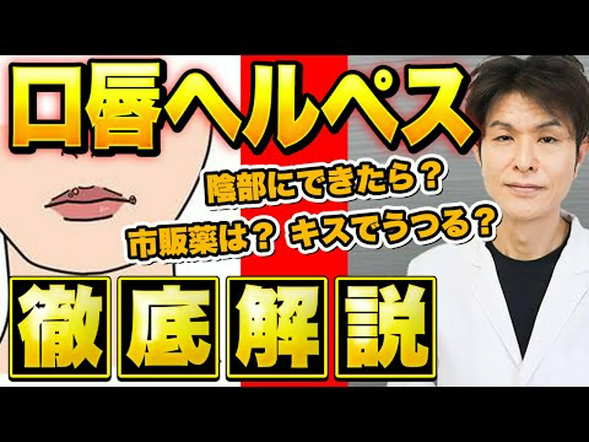 口の中のヘルペスは治りますか?症状と治療法 口の中のヘルペスは治りますか?症状と治療法
