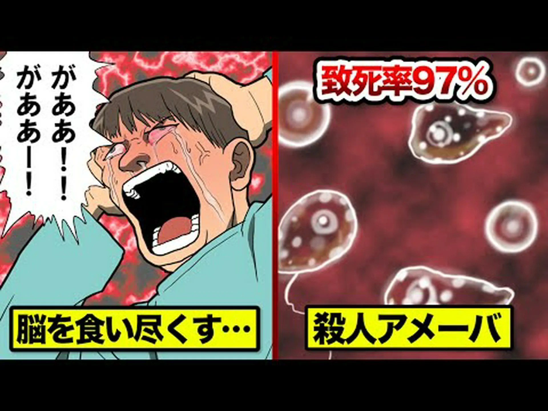 脳を食べるアメーバ、湖で泳いだ男性を死亡 脳を食べるアメーバ、湖で泳いだ男性を死亡