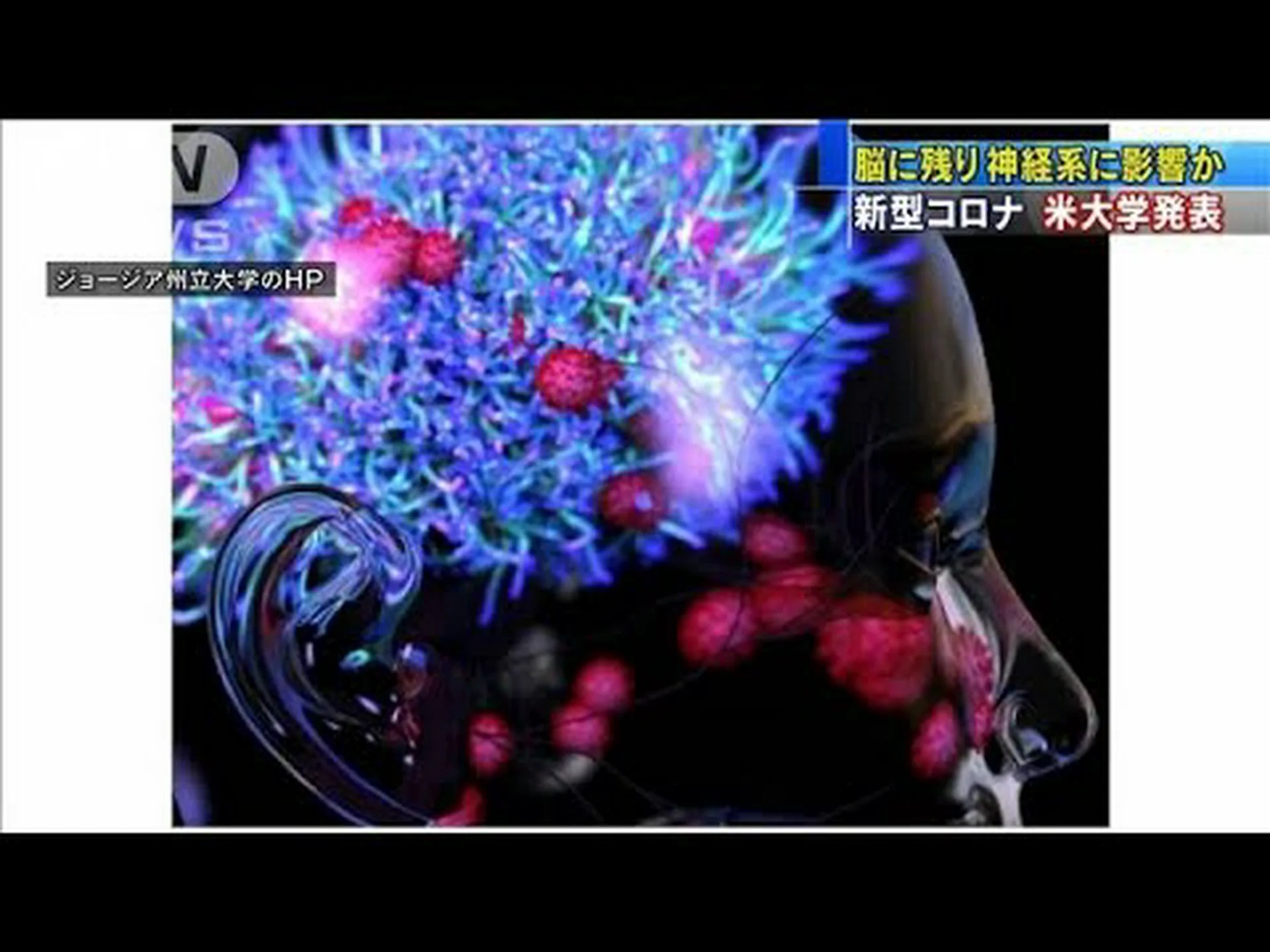 新型コロナウイルス感染症の軽症患者も長期的な問題を引き起こす可能性がある 新型コロナウイルス感染症の軽症患者も長期的な問題を引き起こす可能性がある