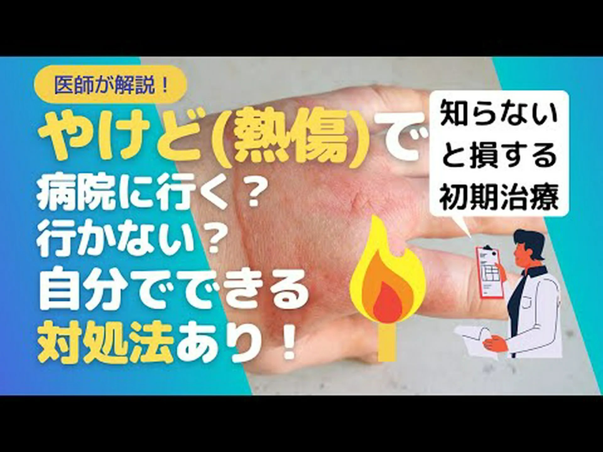 歯磨き粉は本当に火傷を和らげるのに役立ちますか? 歯磨き粉は本当に火傷を和らげるのに役立ちますか?