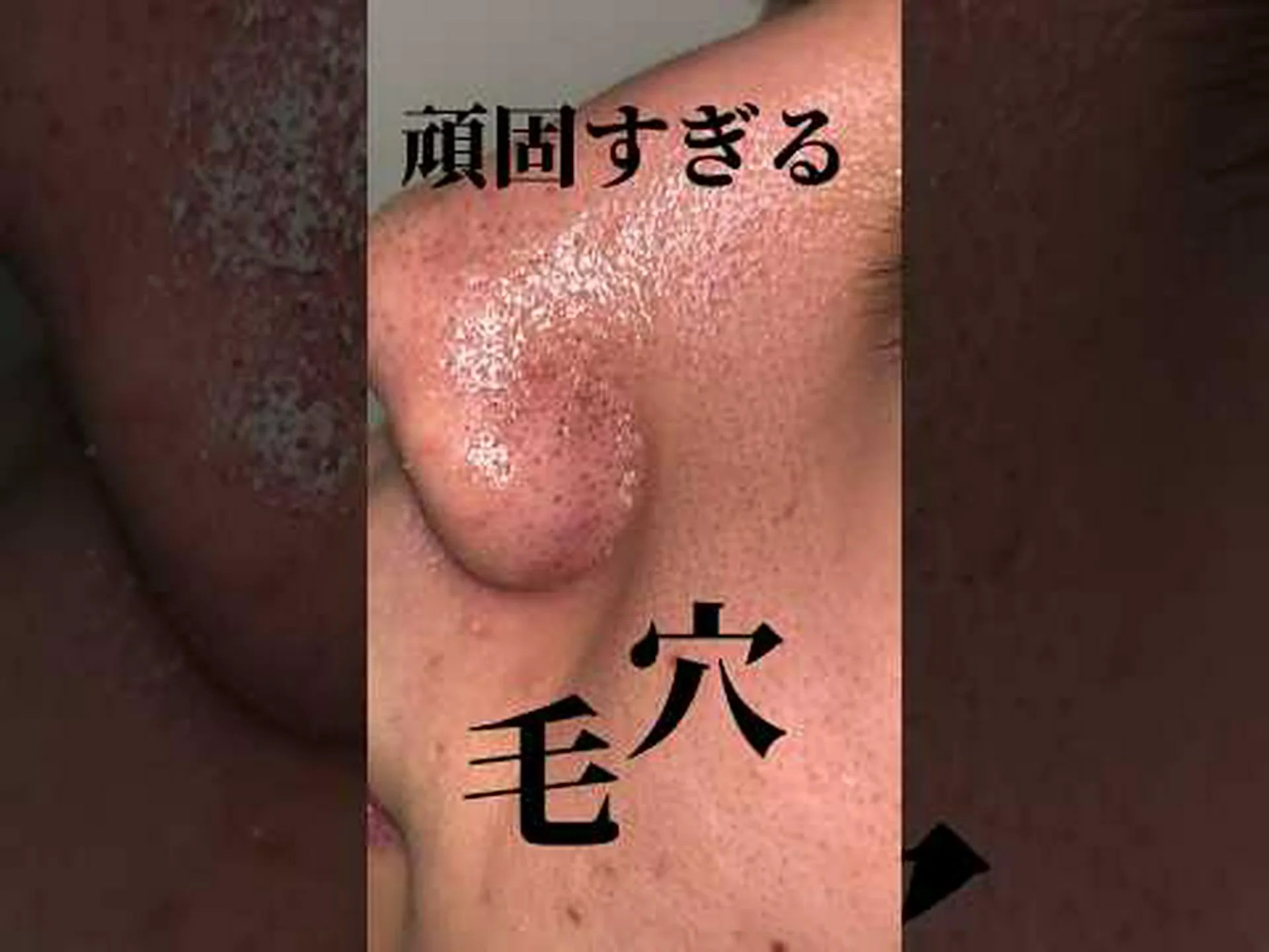 顔用の5つの自家製角質除去剤 顔用の5つの自家製角質除去剤